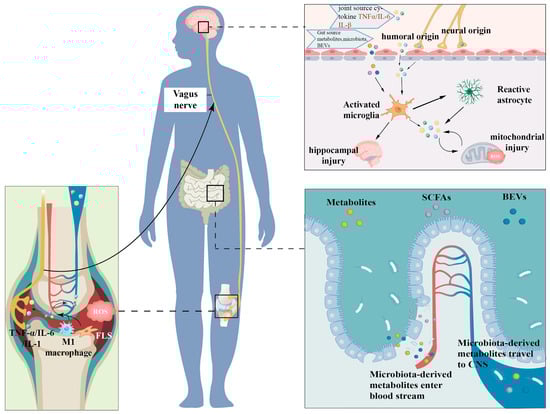 Comorbidity Mechanisms of Rheumatoid Arthritis-Associated Depression.