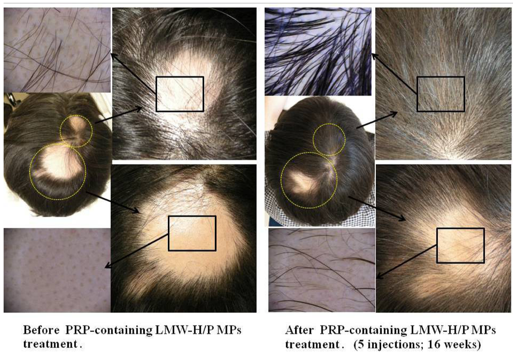 Pharmaceutics 04 00042 g004 1024