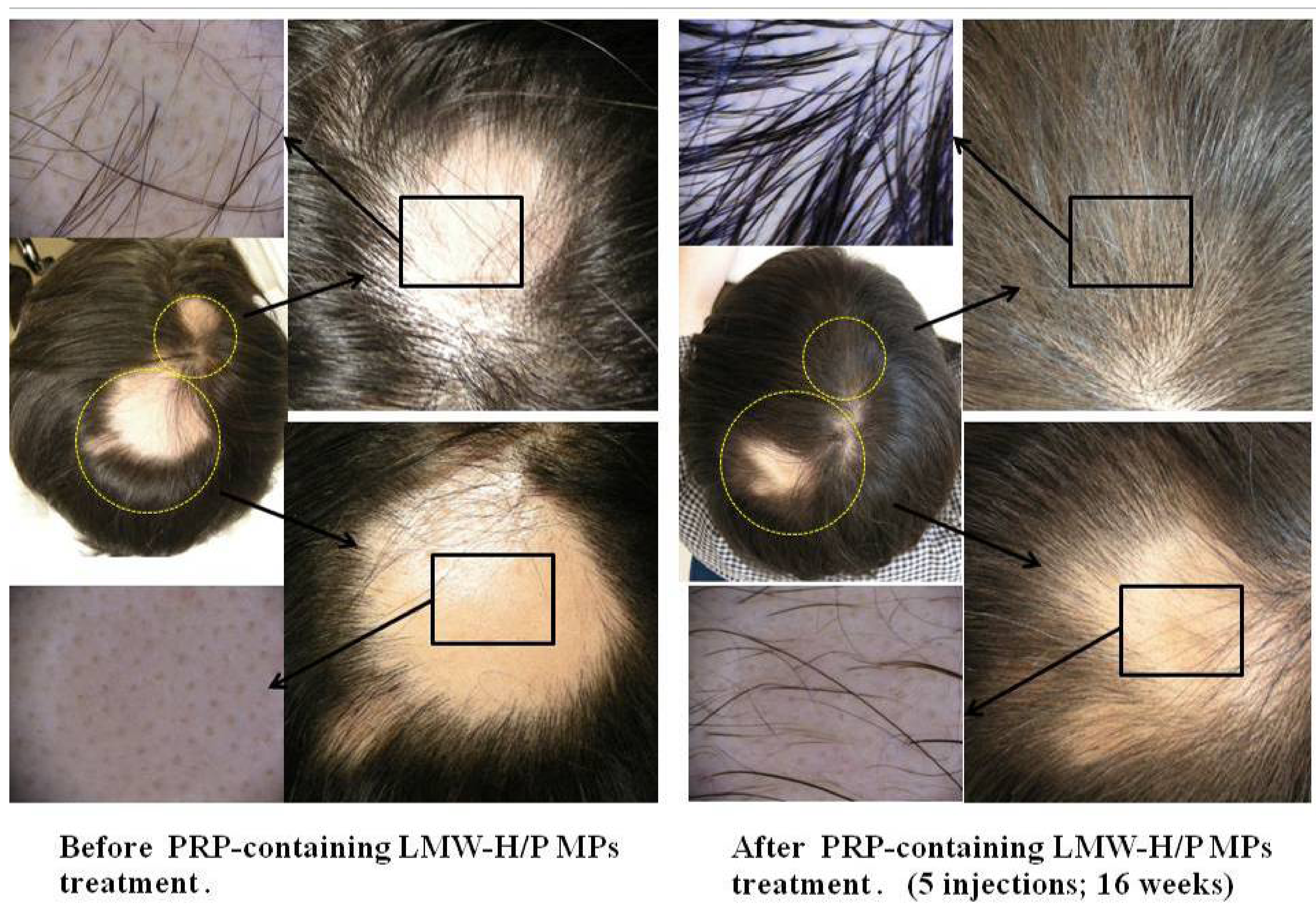 Pharmaceutics 04 00042 g004
