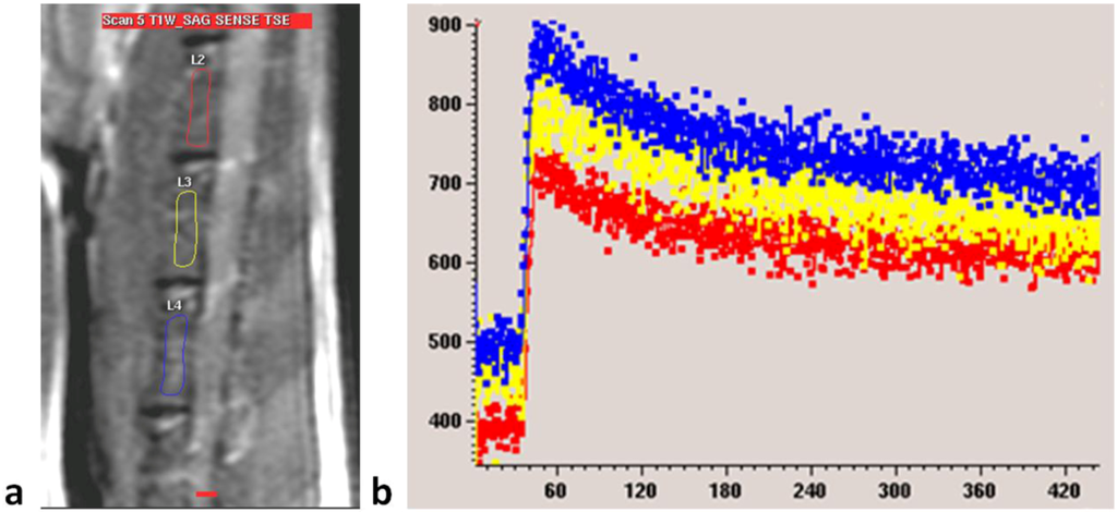 Pharmaceutics 05 00023 g006 1024