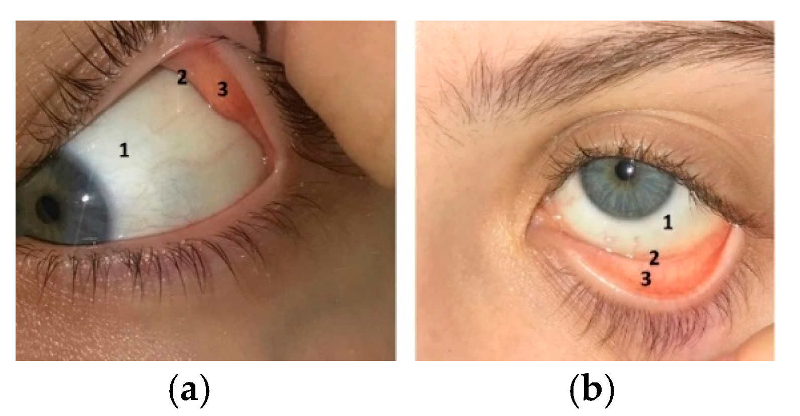 Pharmaceutics 11 00321 g004 Pharmaceutics 11 00321 g004