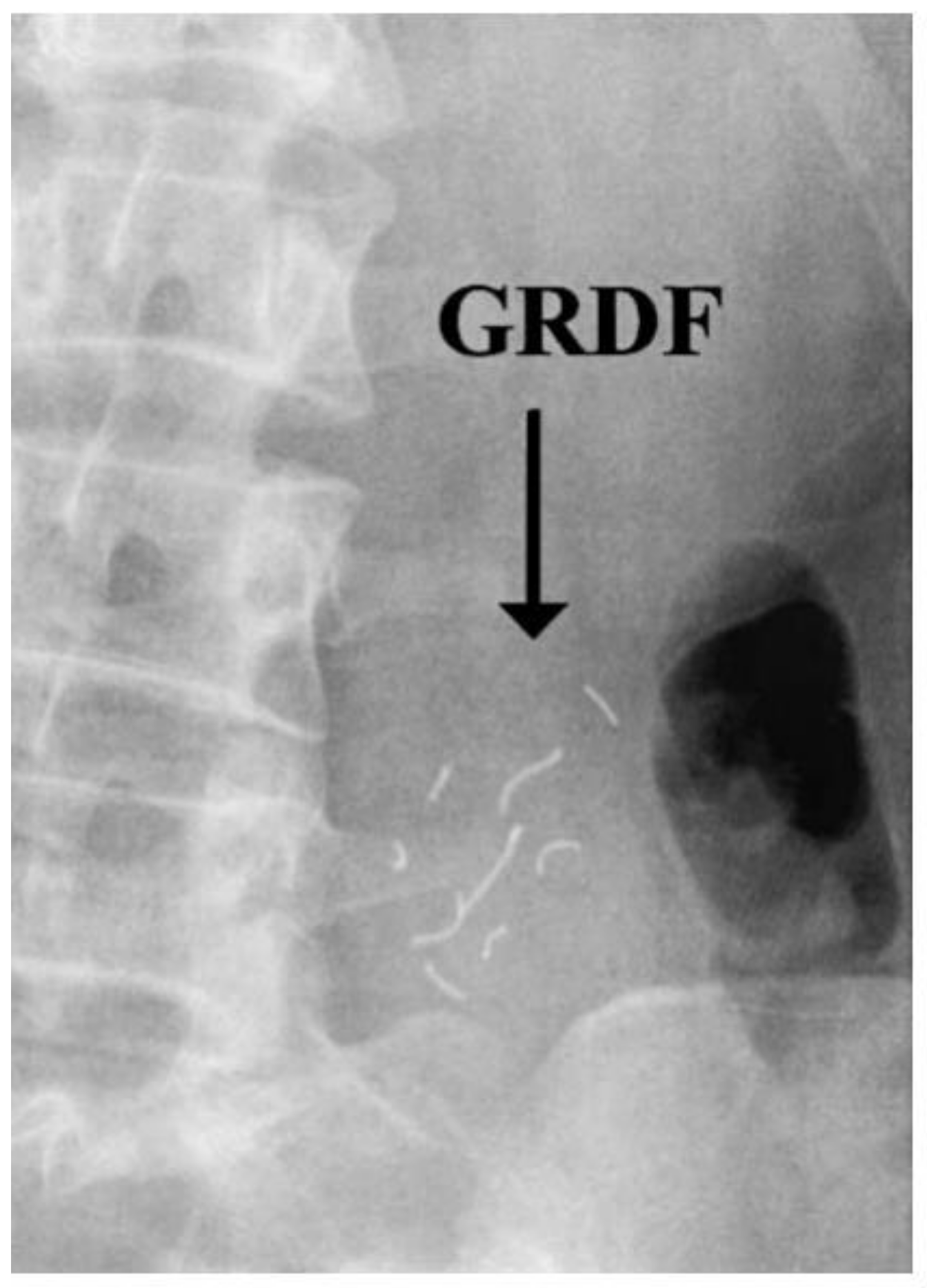 Pharmaceutics 11 00416 g016