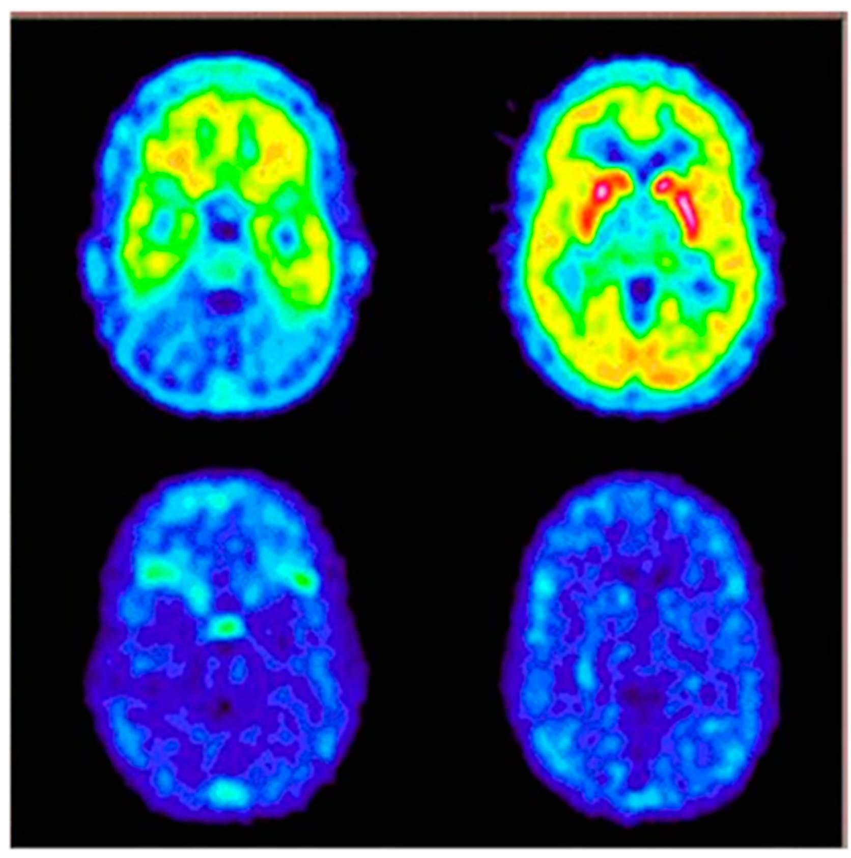 Pharmaceutics 11 00443 g008 Pharmaceutics 11 00443 g008