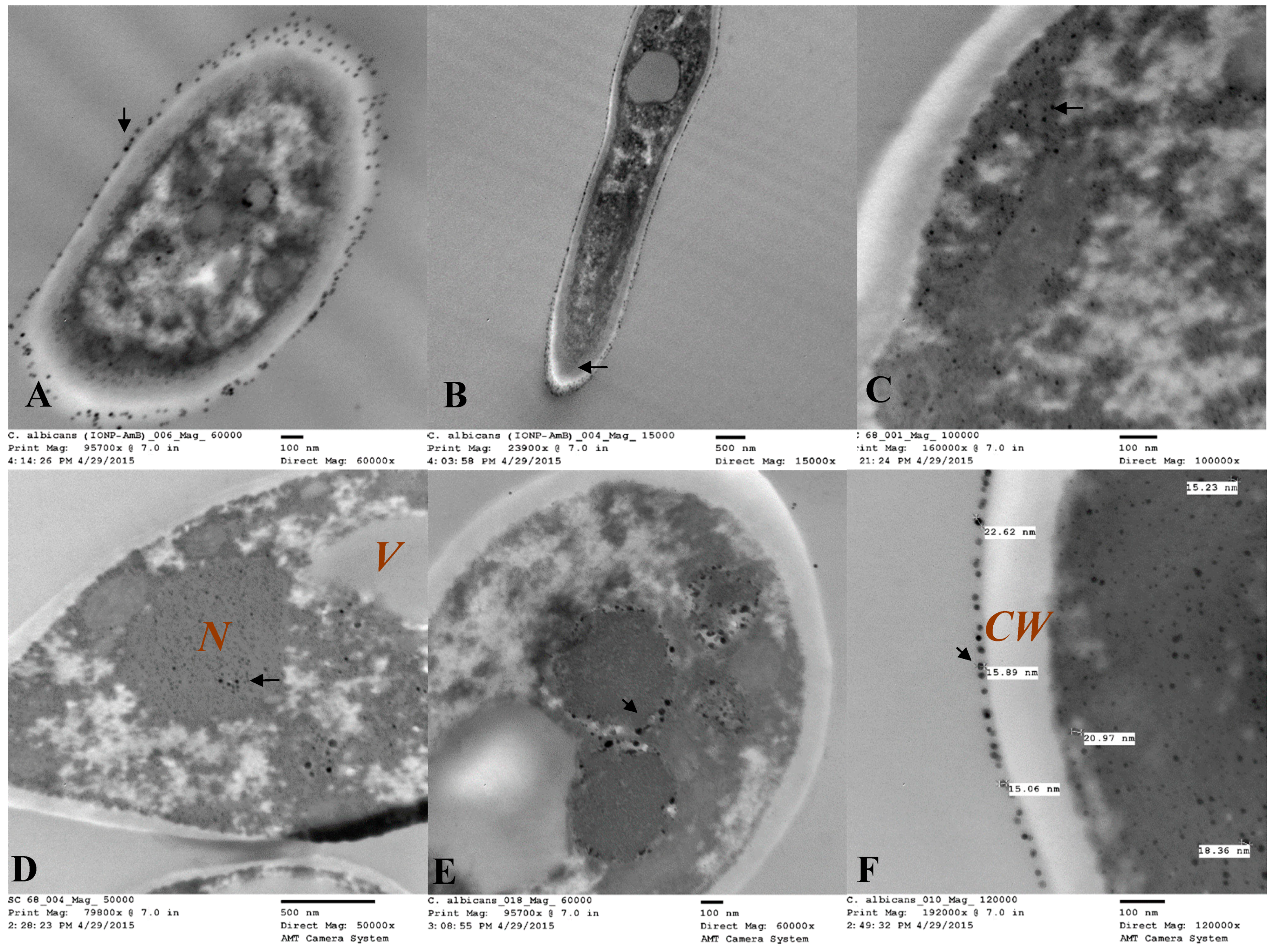 Pharmaceutics 12 00247 g017 Pharmaceutics 12 00247 g017