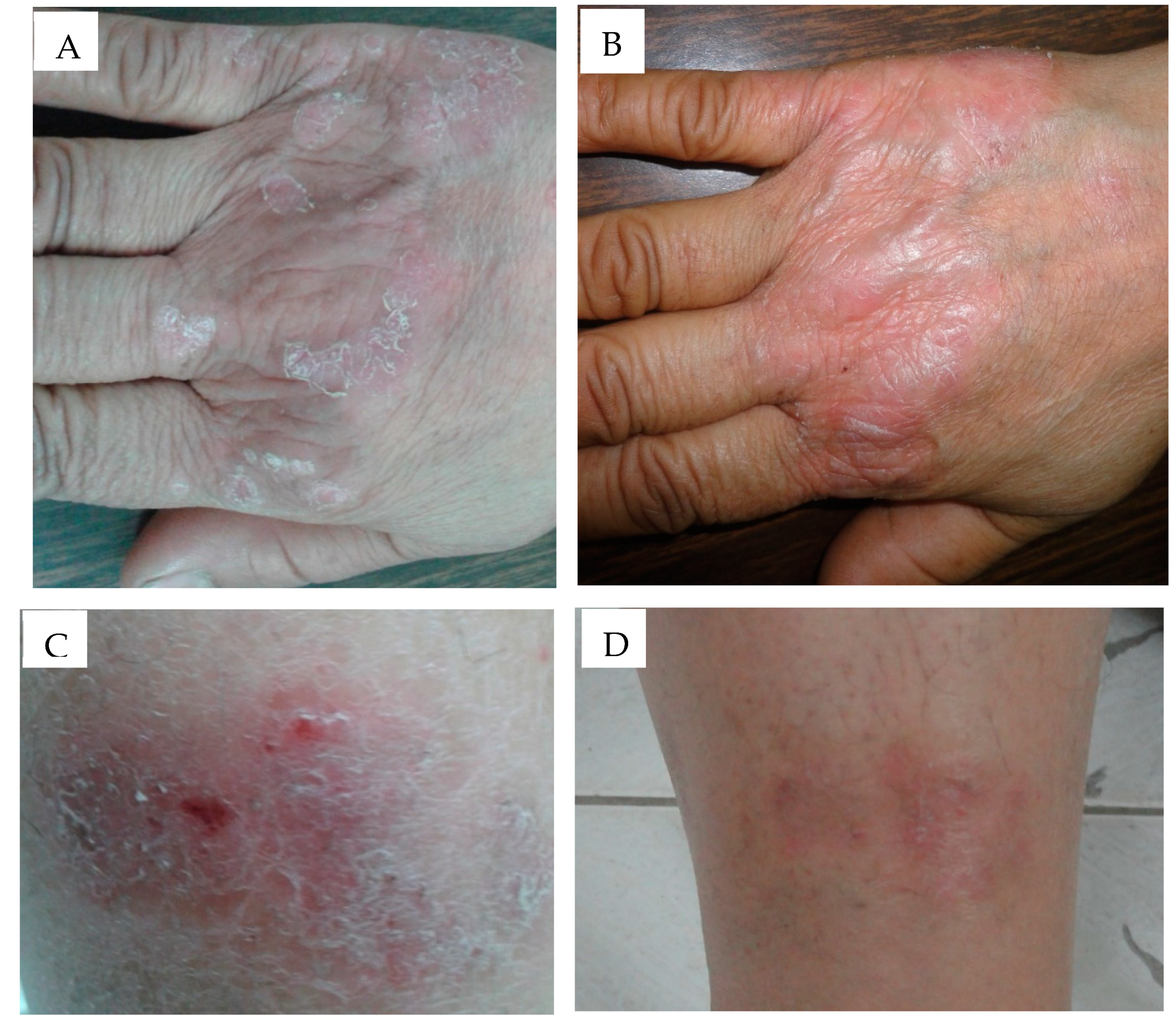 Pharmaceutics 12 00446 g006 Pharmaceutics 12 00446 g006