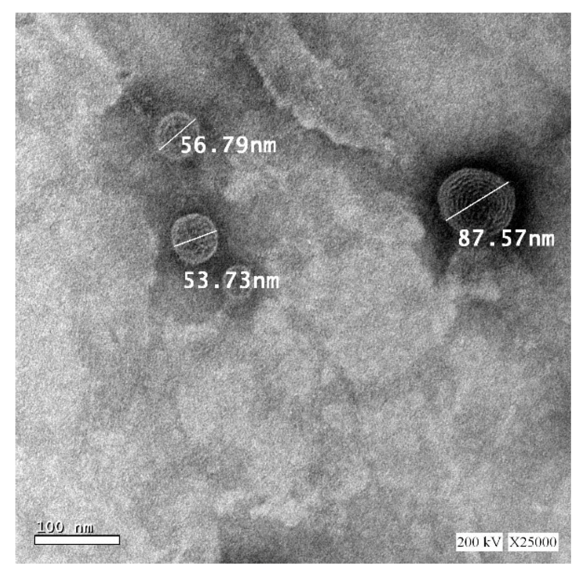 Pharmaceutics 12 00485 g005 Pharmaceutics 12 00485 g005