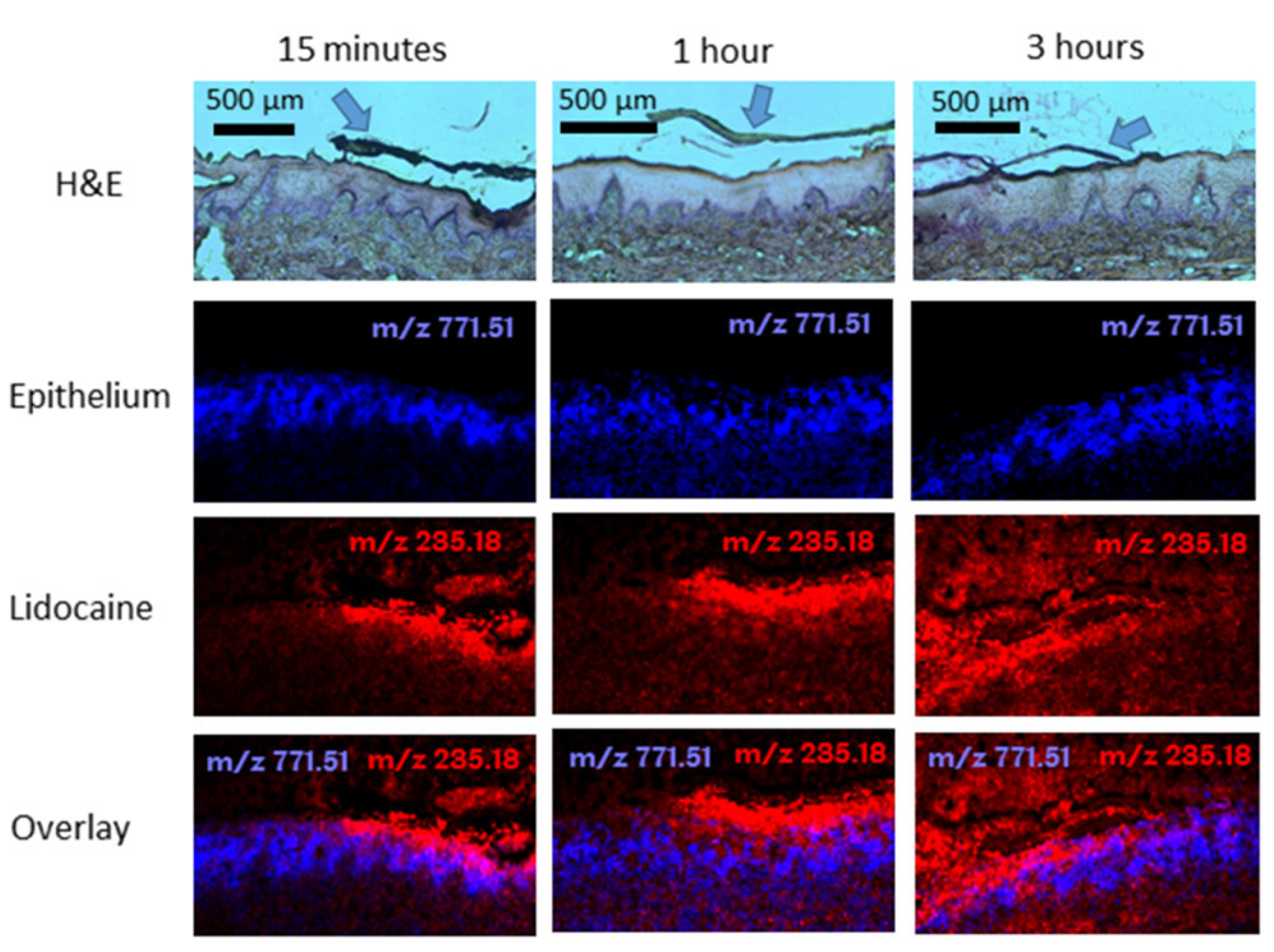 Pharmaceutics 12 00504 g006 Pharmaceutics 12 00504 g006