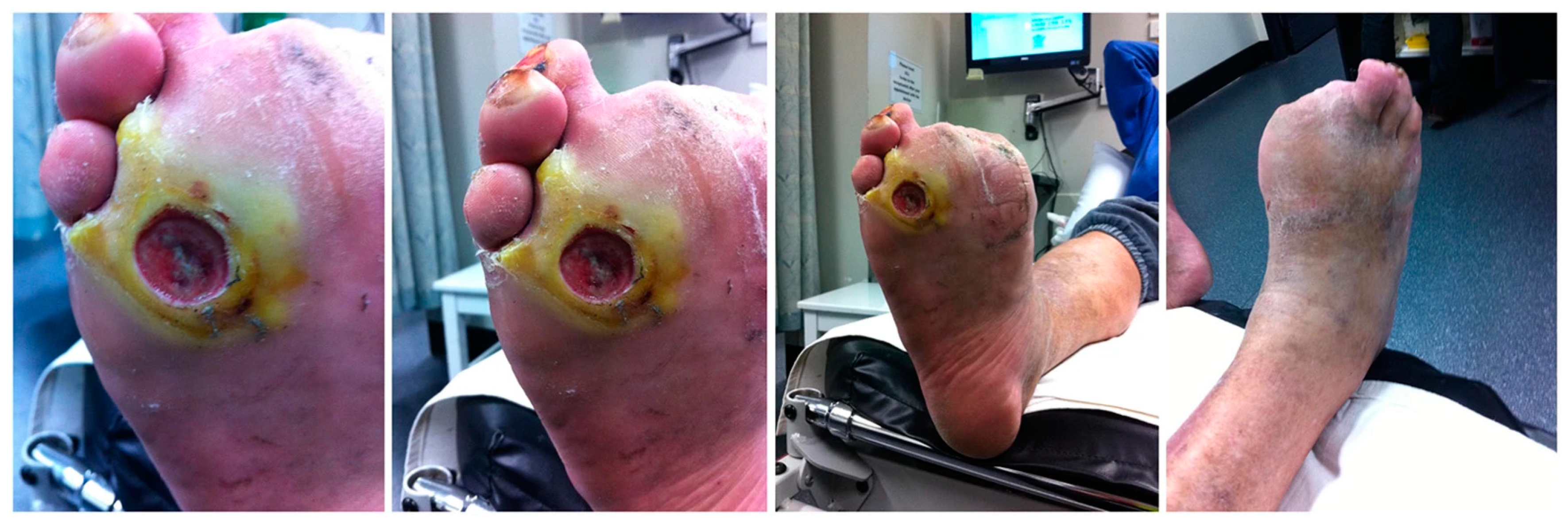 Pharmaceutics 12 00881 g001