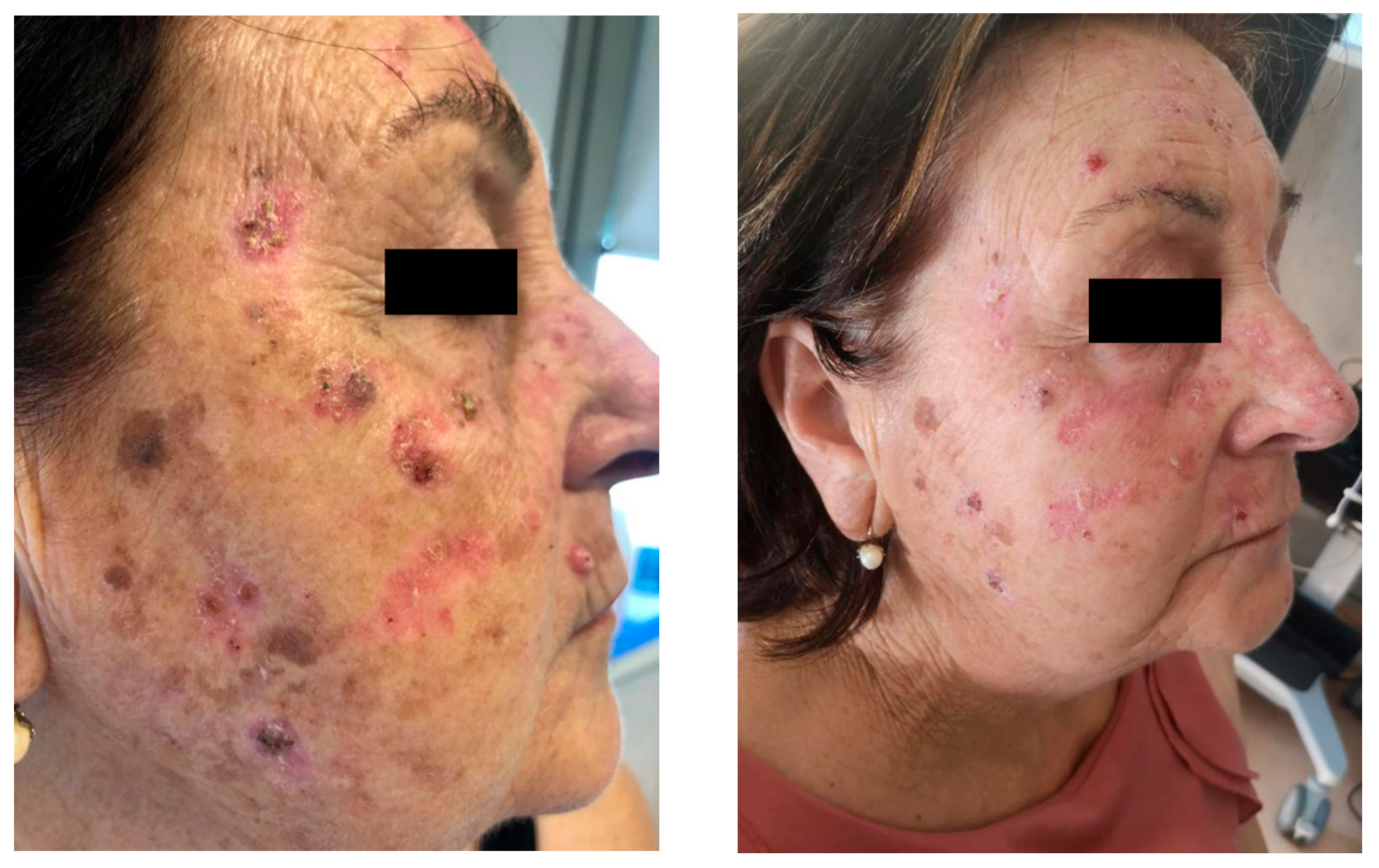 Pharmaceutics 12 01104 g001