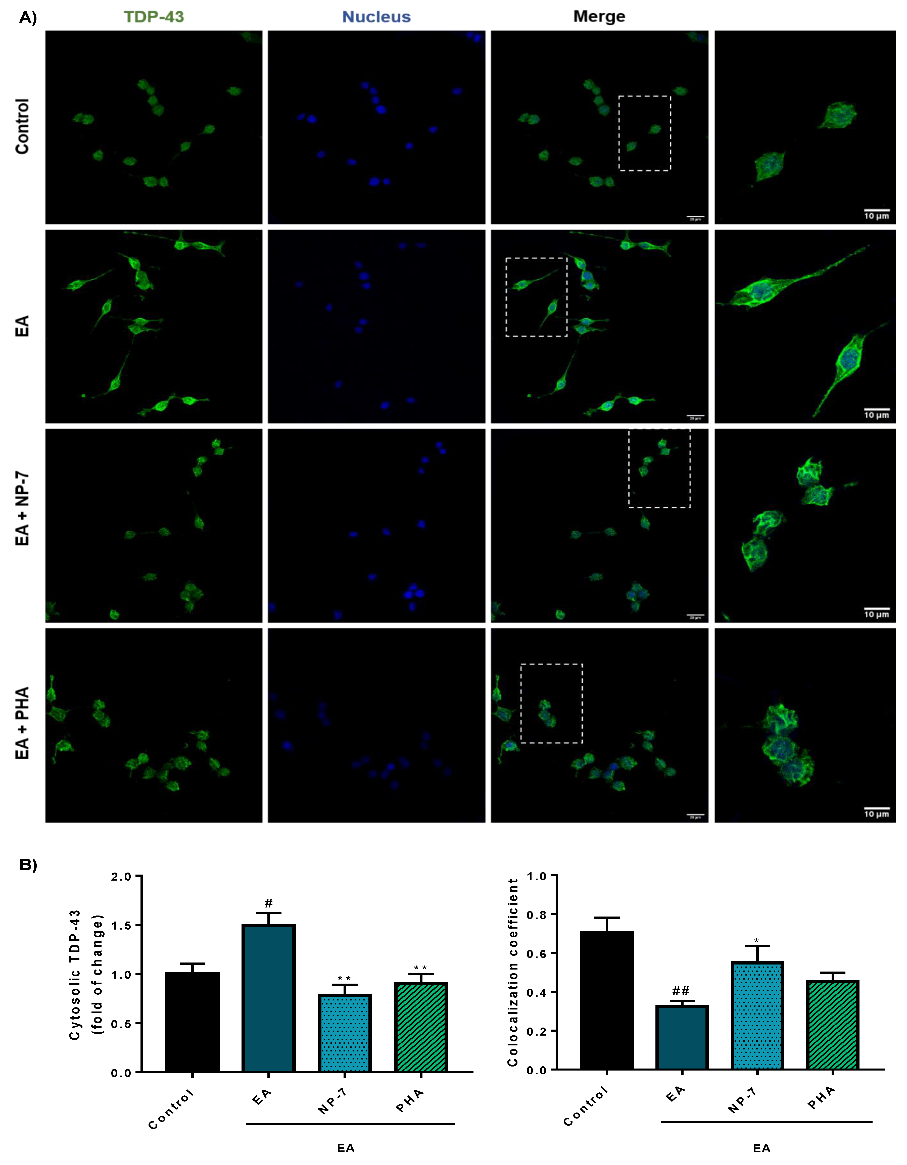 Pharmaceutics 13 00180 g008