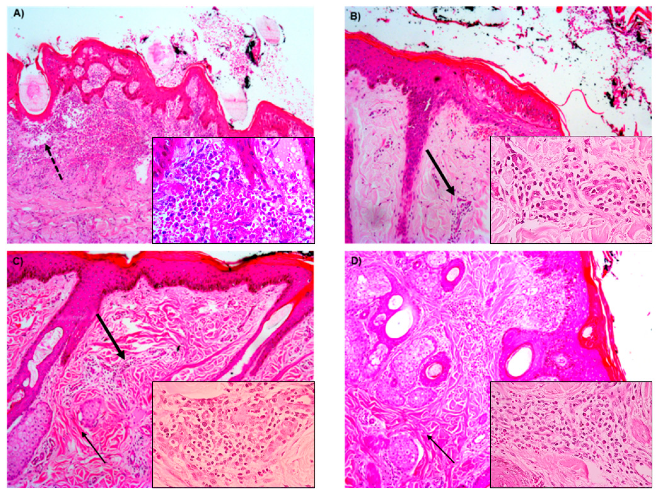 Pharmaceutics 13 00688 g005 Pharmaceutics 13 00688 g005
