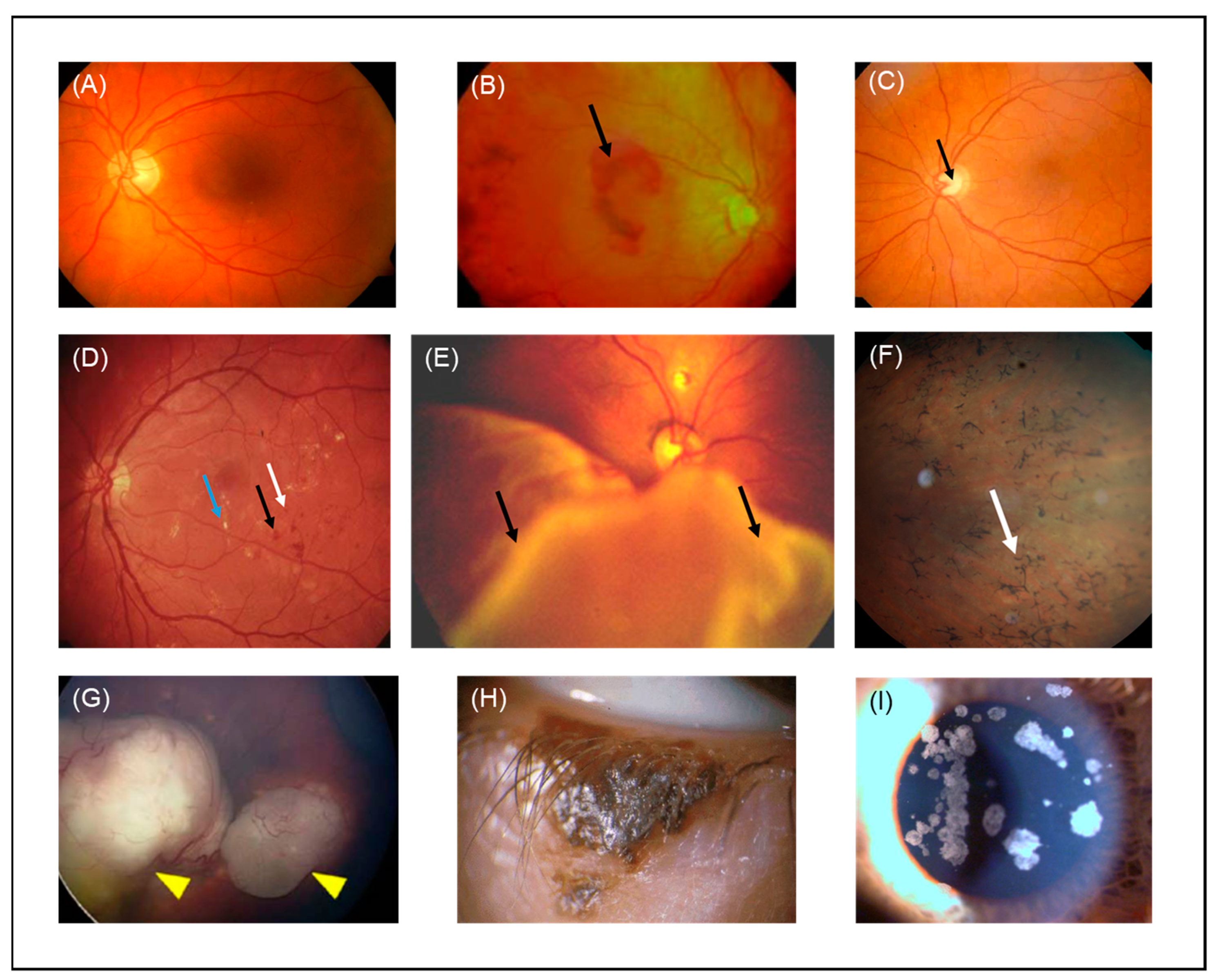Pharmaceutics 13 01782 g004
