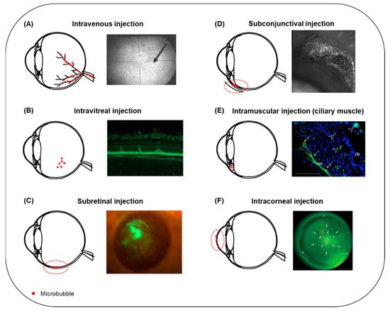 Pharmaceutics 13 01782 g005 Pharmaceutics 13 01782 g005