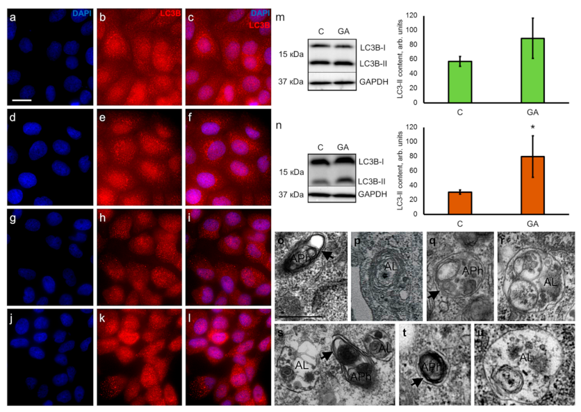 Pharmaceutics 13 01813 g003