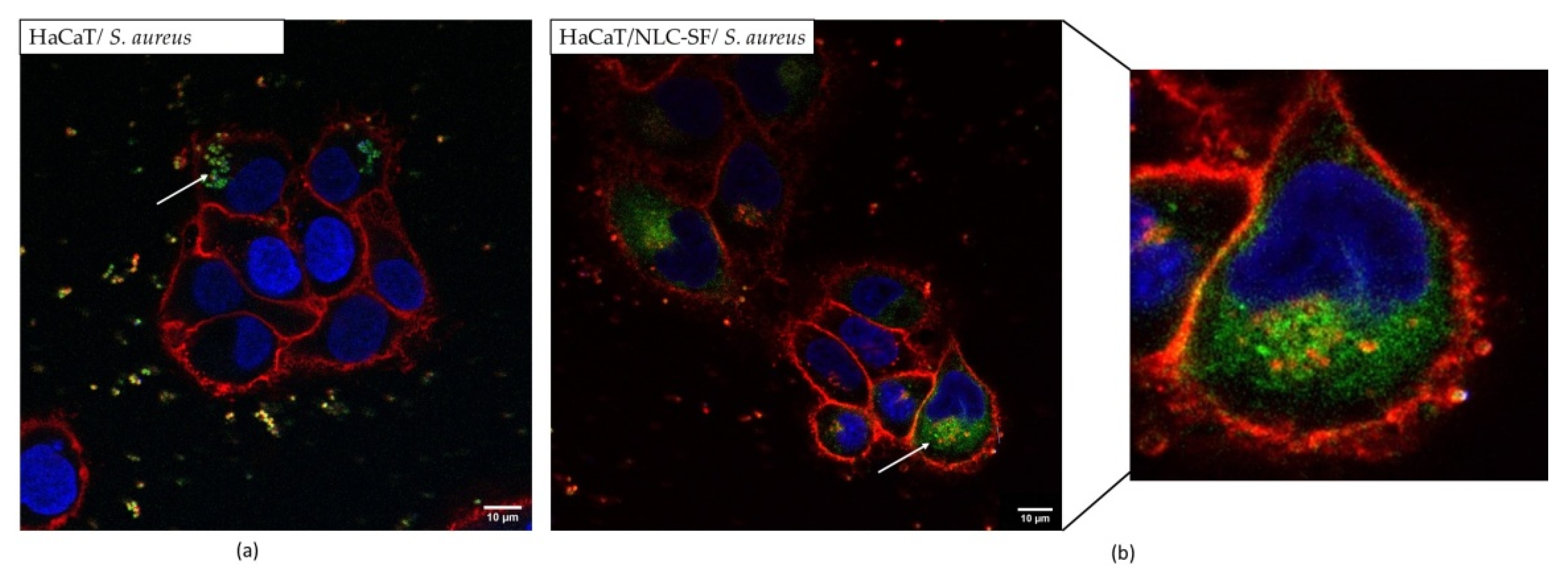 Pharmaceutics 13 01950 g012