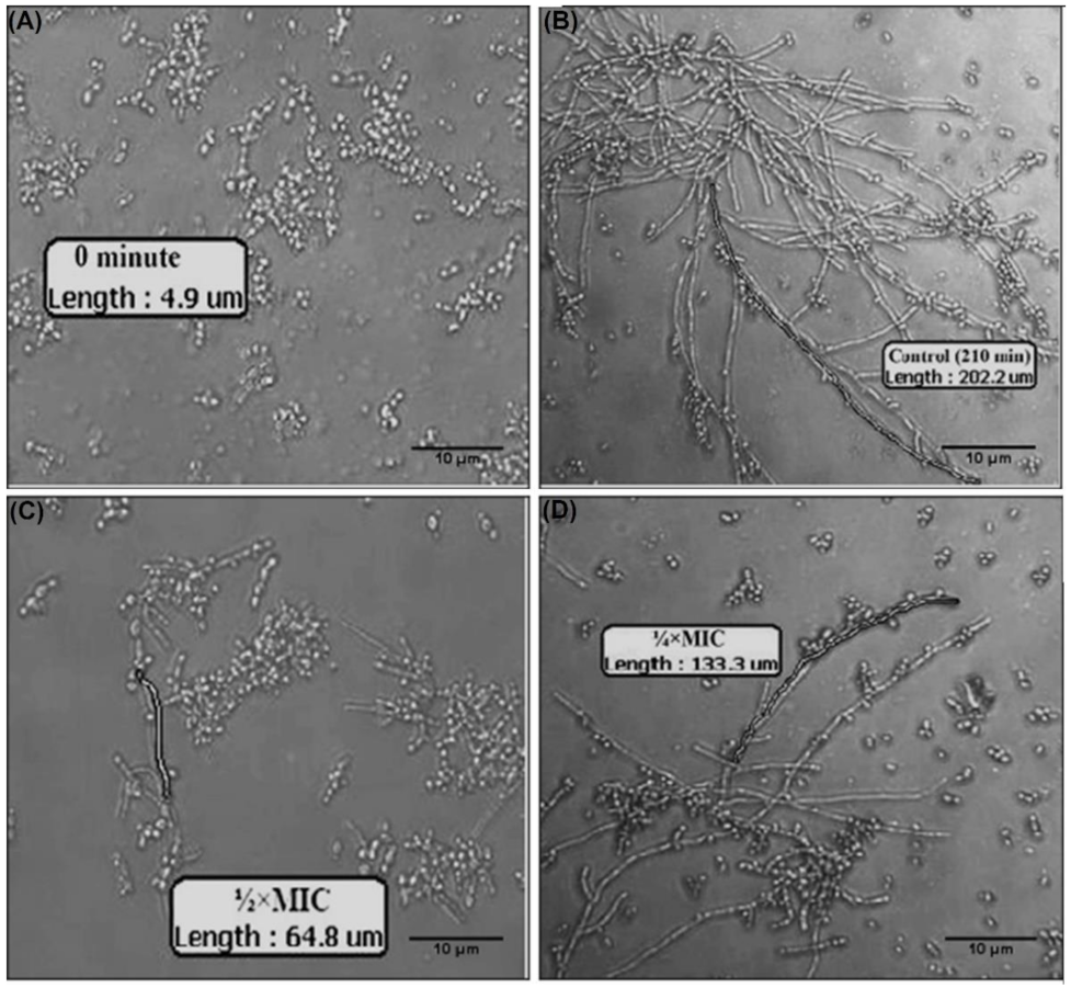Pharmaceutics 13 01957 g011