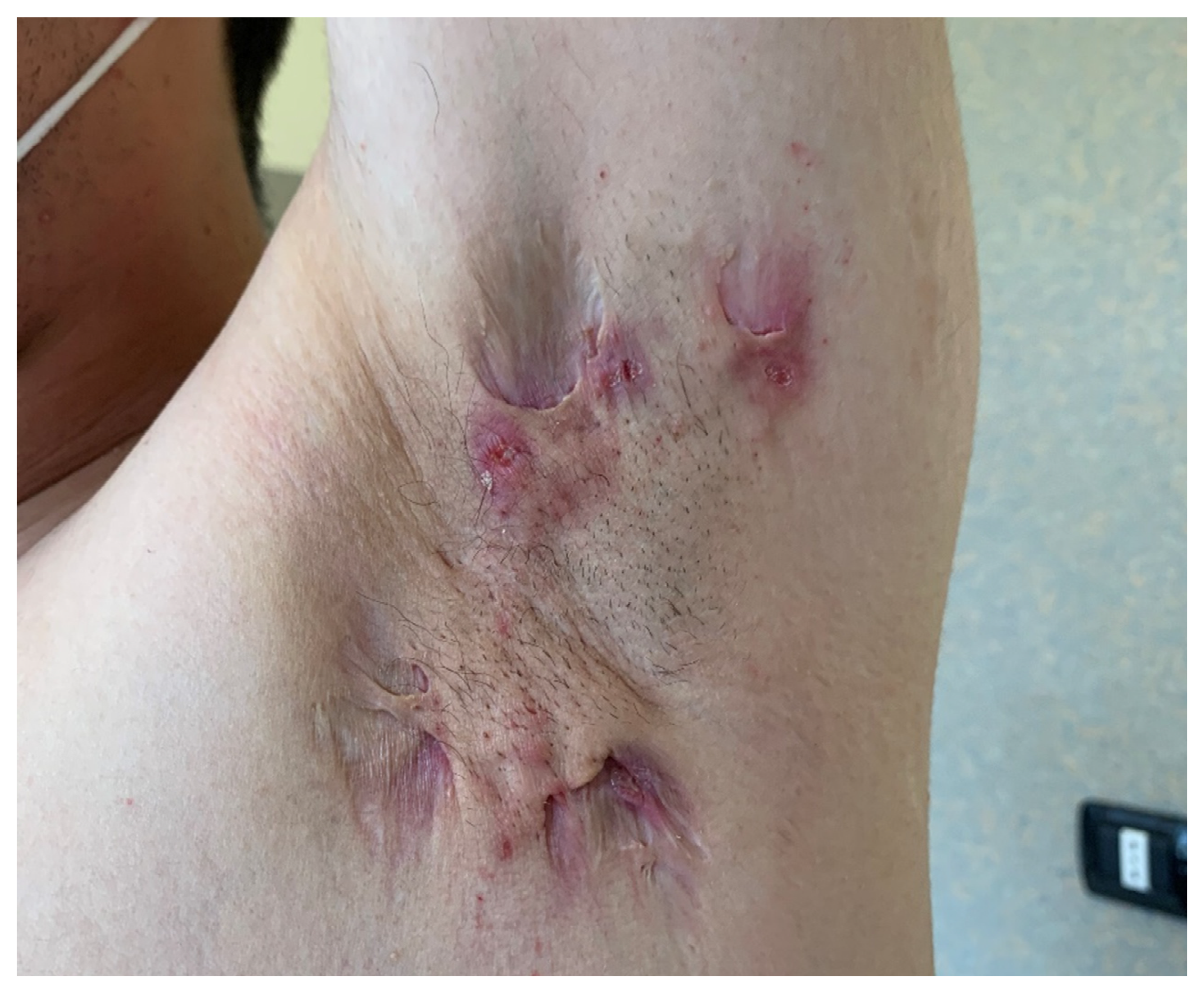 Pharmaceutics 14 00294 g004