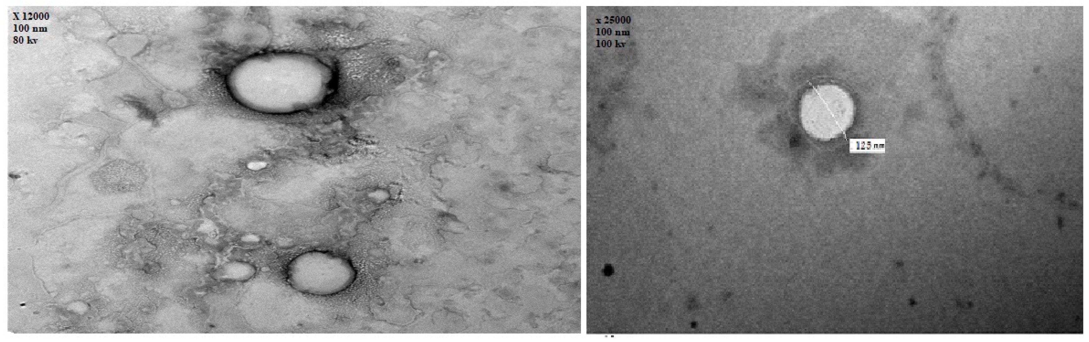 Pharmaceutics 14 00410 g004