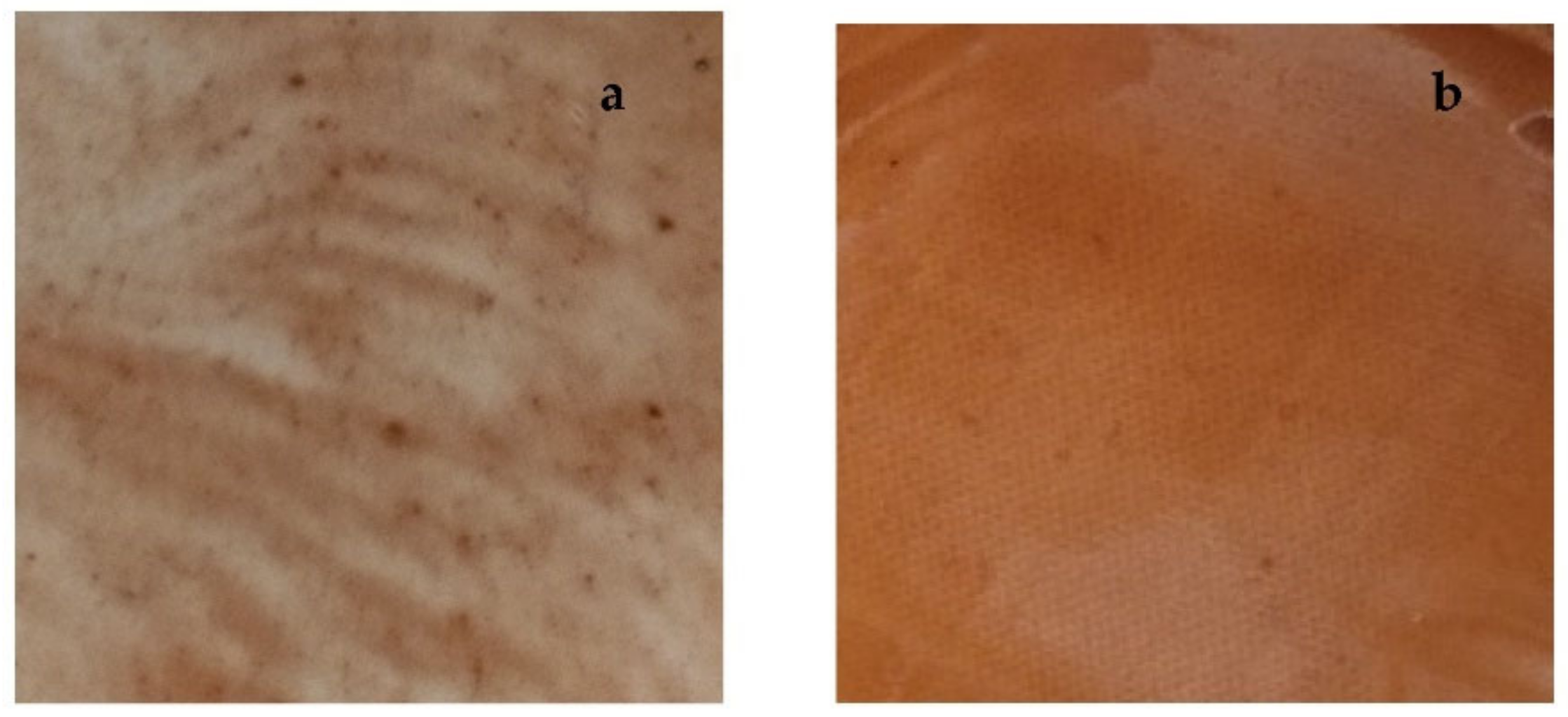 Pharmaceutics 14 00485 g006