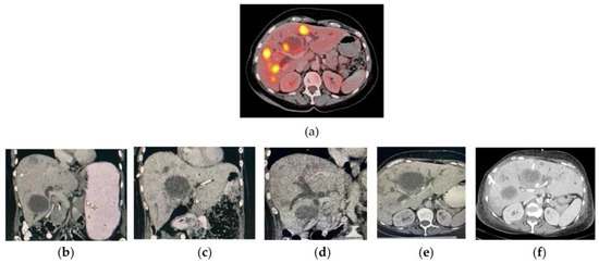 Pharmaceutics 14 00720 g0a1 550