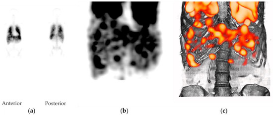 Pharmaceutics 14 00720 g0a2 550