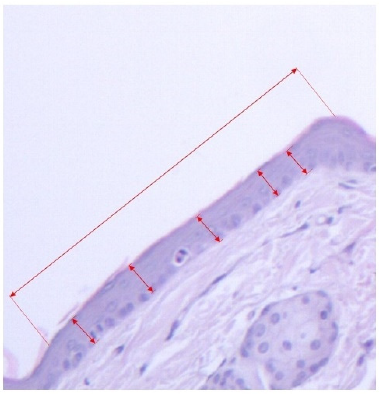 Pharmaceutics 14 00885 g003 Pharmaceutics 14 00885 g003
