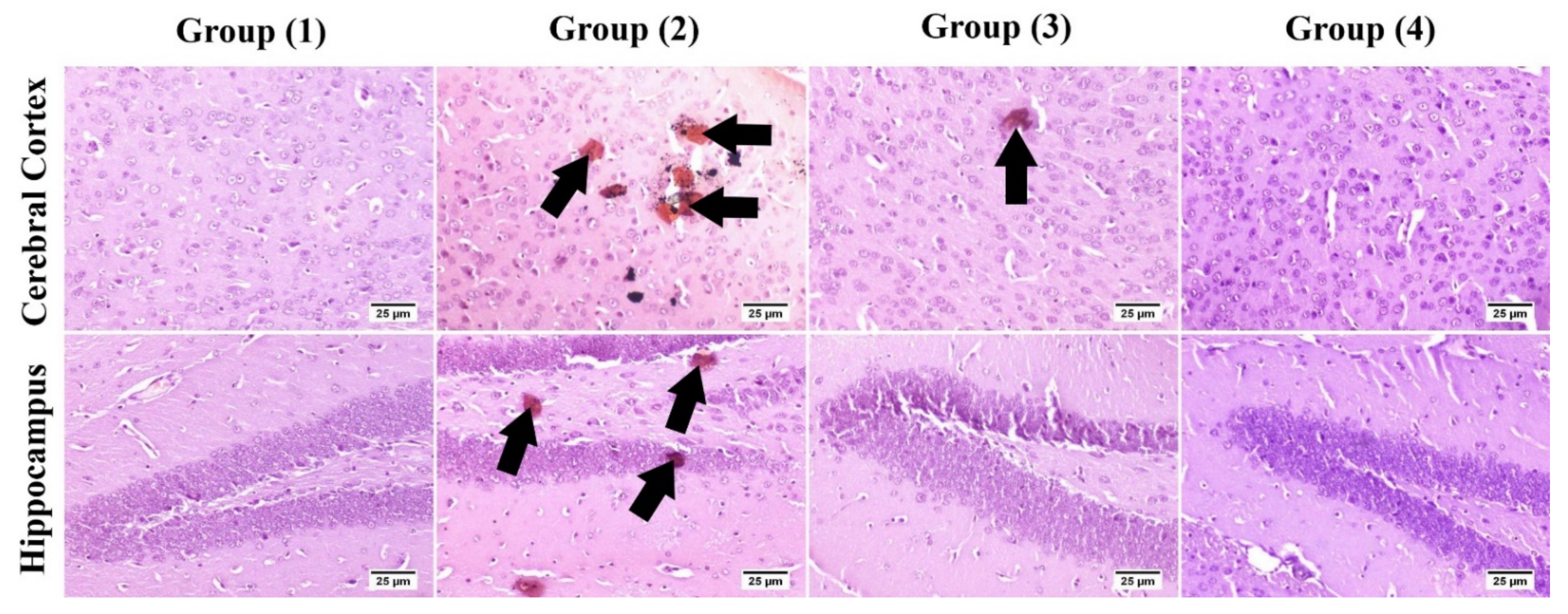 Pharmaceutics 14 01003 g008