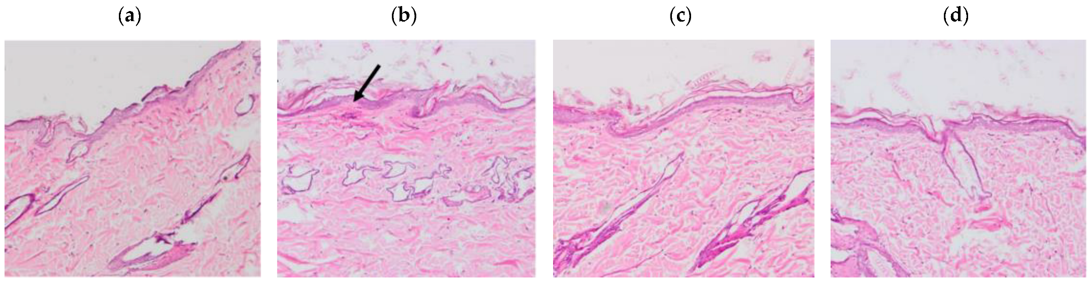 Pharmaceutics 14 01011 g007