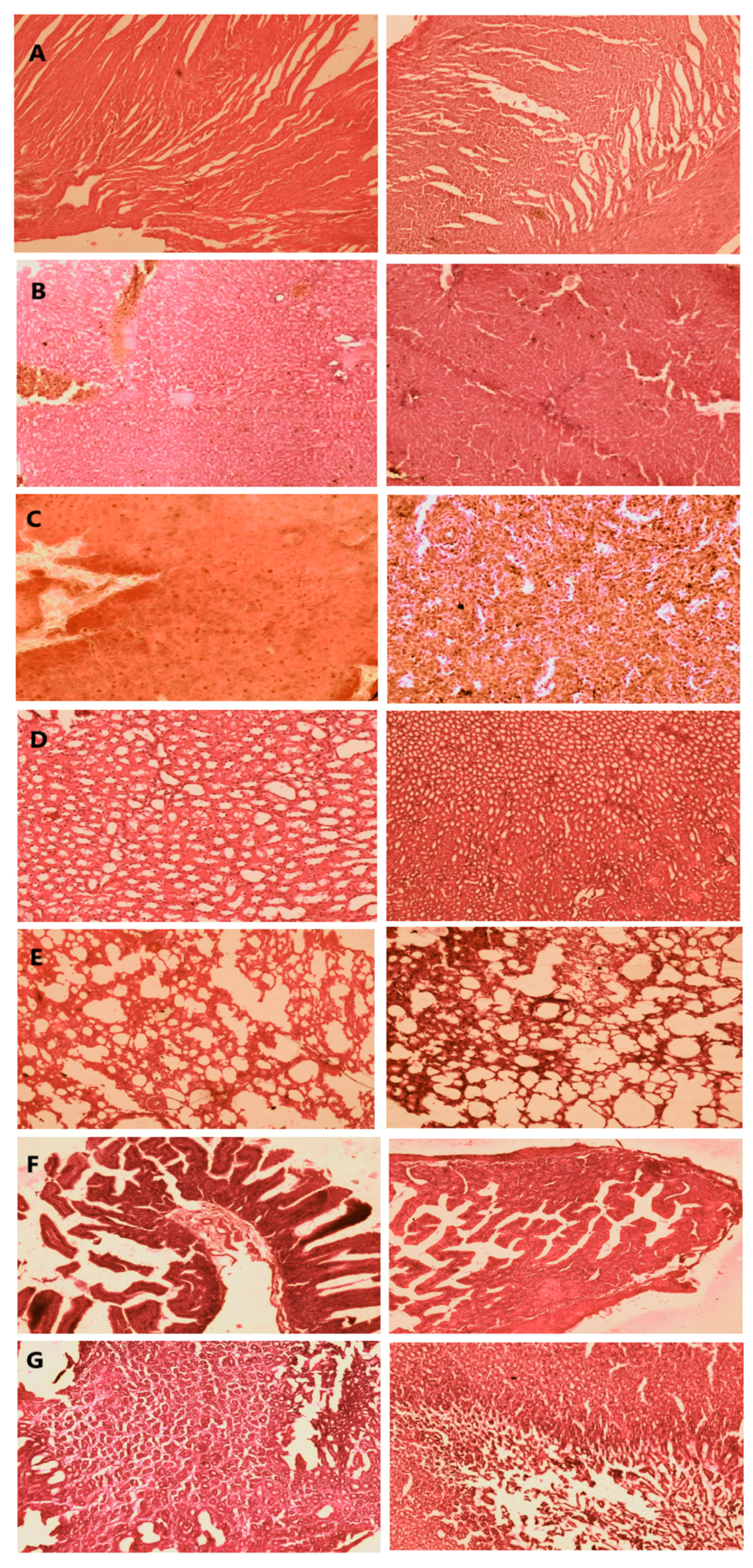 Pharmaceutics 14 01218 g011