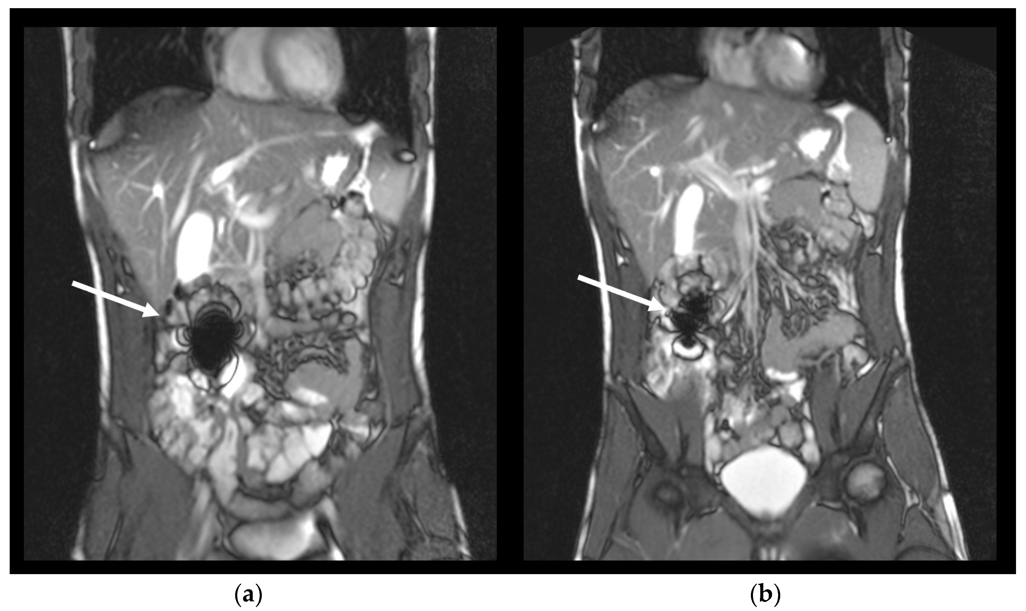 Pharmaceutics 14 01999 g001 Pharmaceutics 14 01999 g001