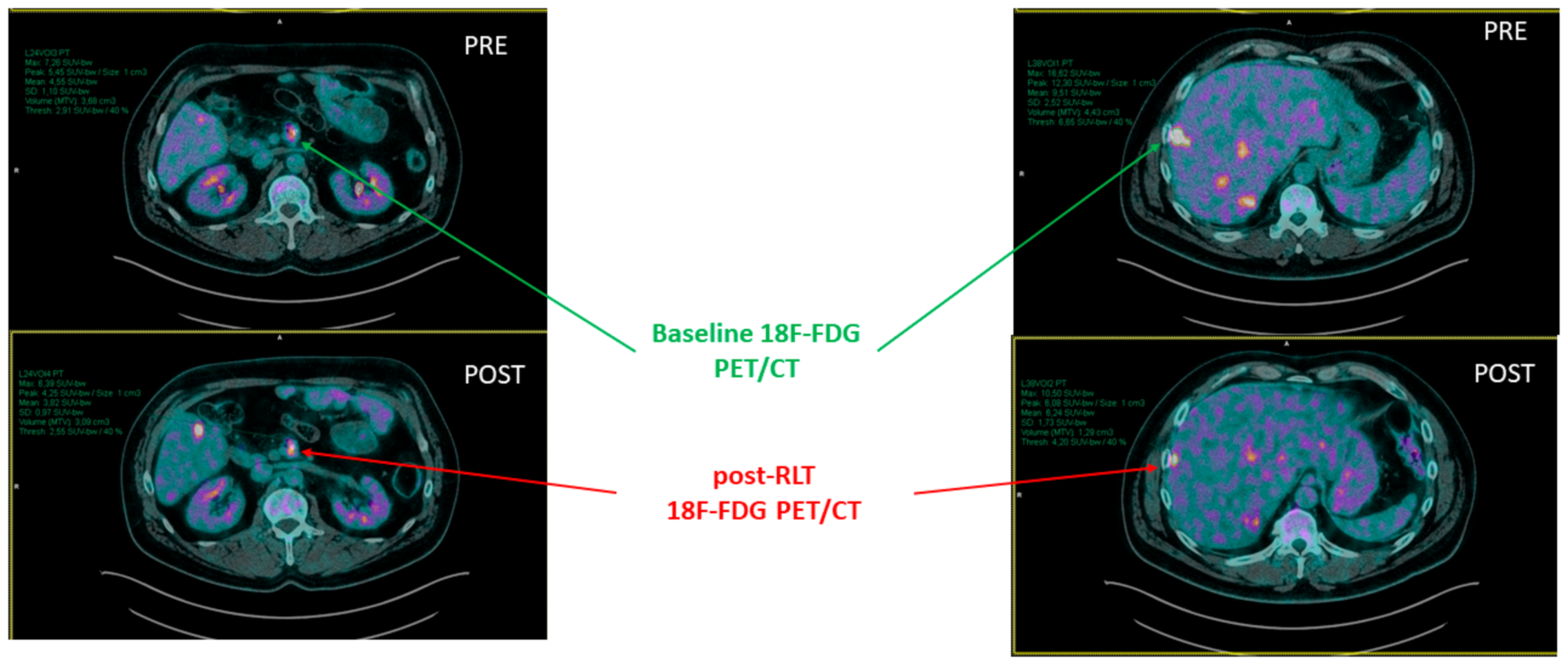 Pharmaceutics 14 02009 g002 Pharmaceutics 14 02009 g002