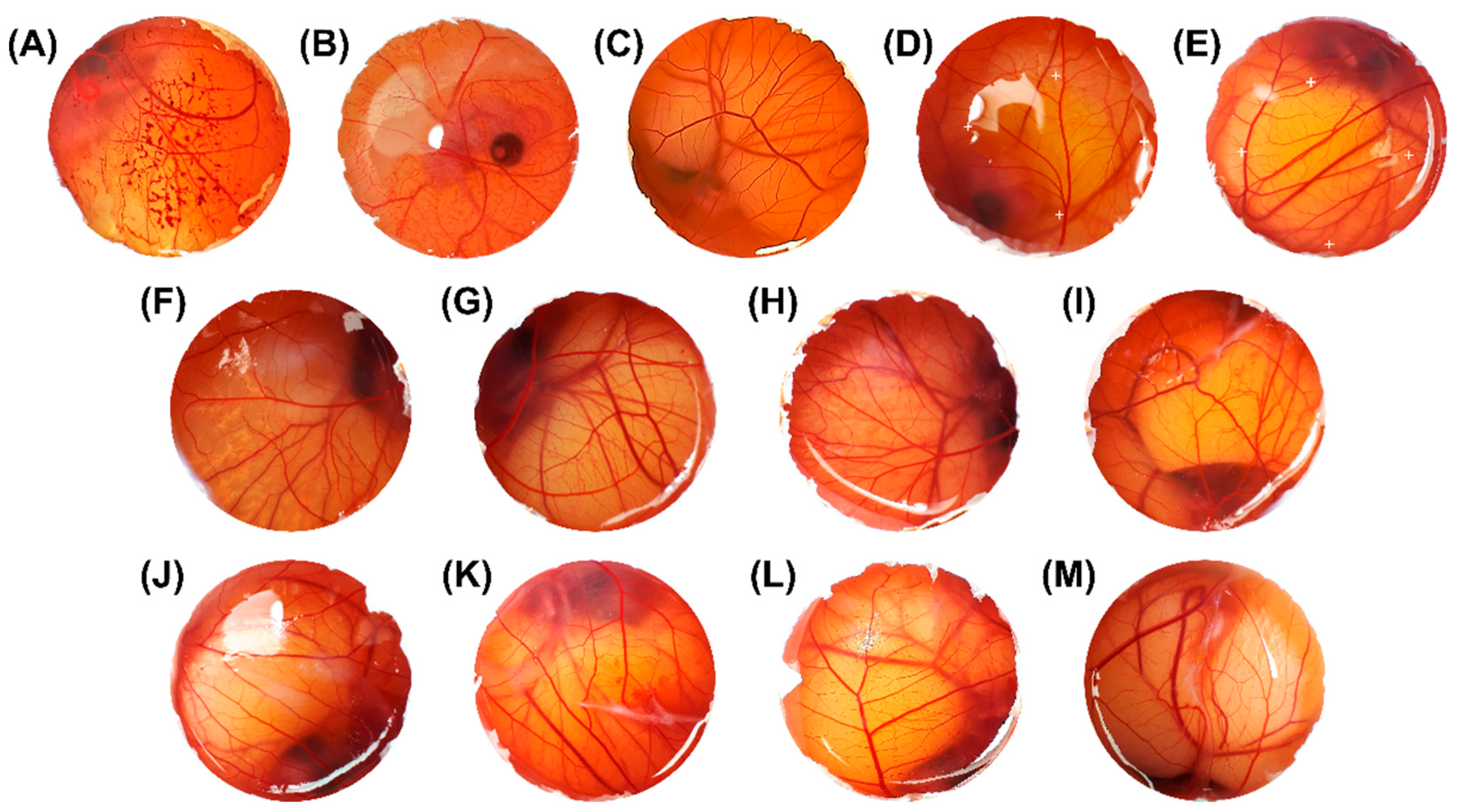Pharmaceutics 14 02525 g011 Pharmaceutics 14 02525 g011