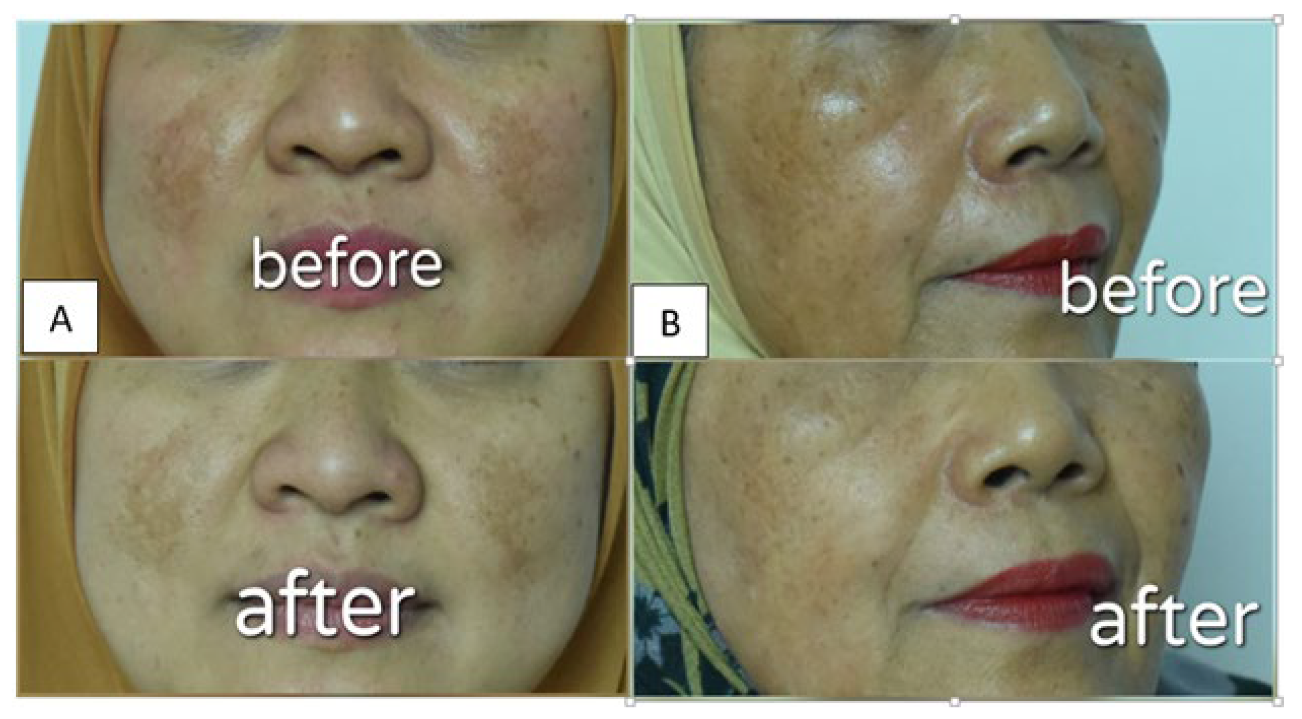 Pharmaceutics 14 02741 g006