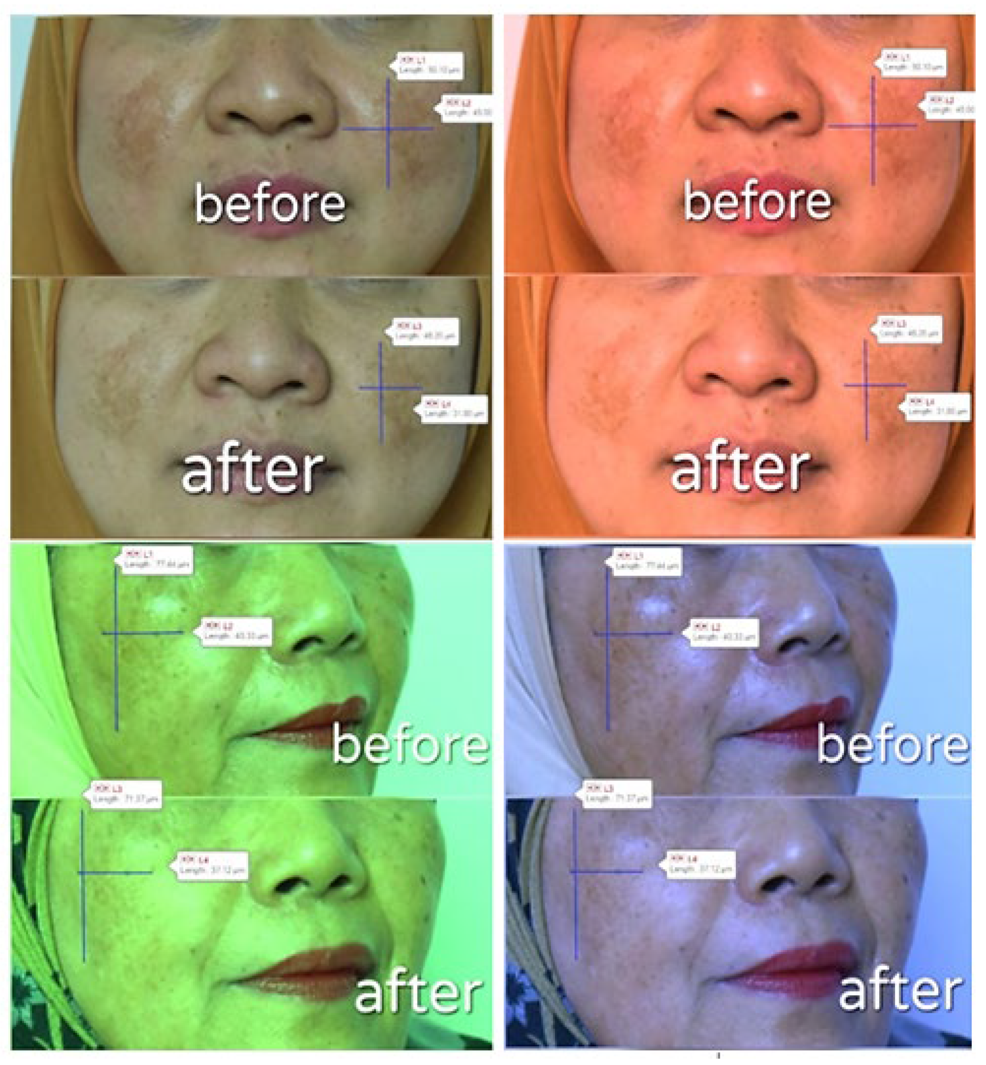 Pharmaceutics 14 02741 g008