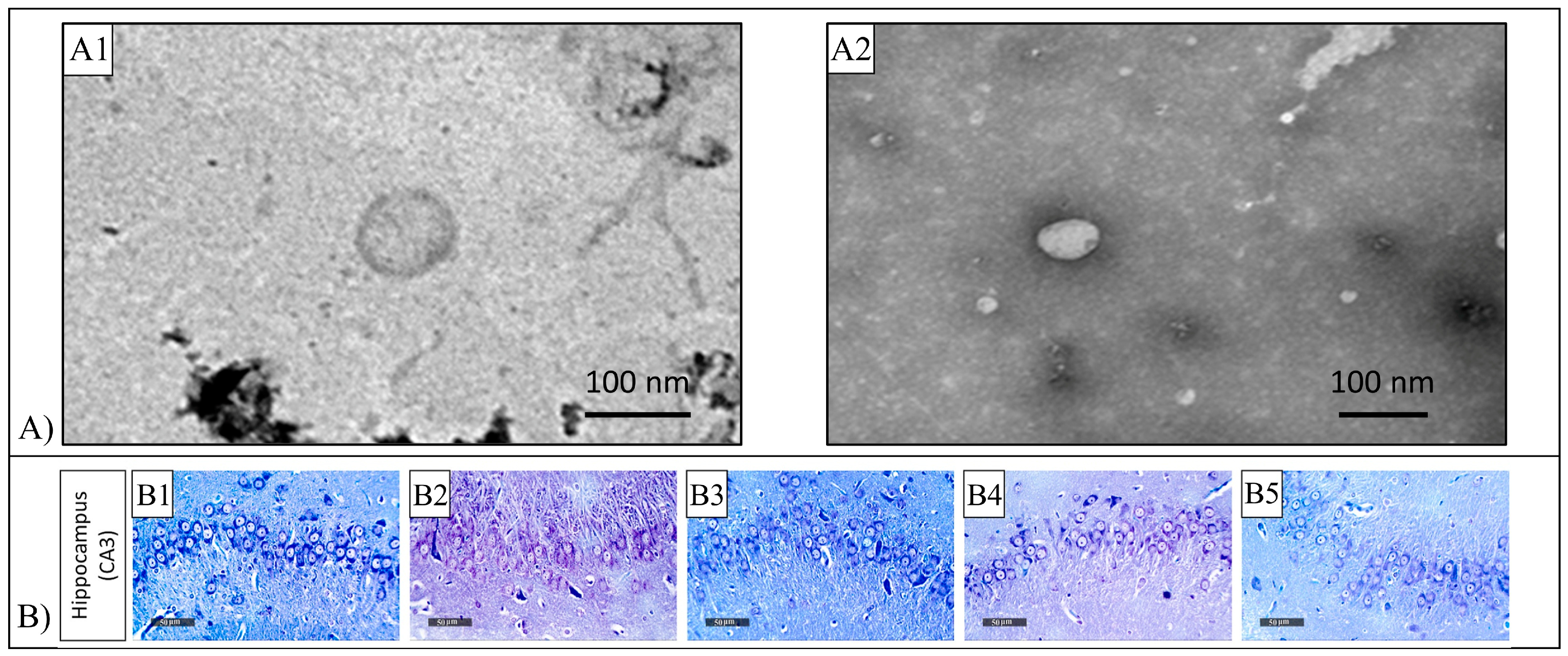 Pharmaceutics 15 00628 g011 Pharmaceutics 15 00628 g011