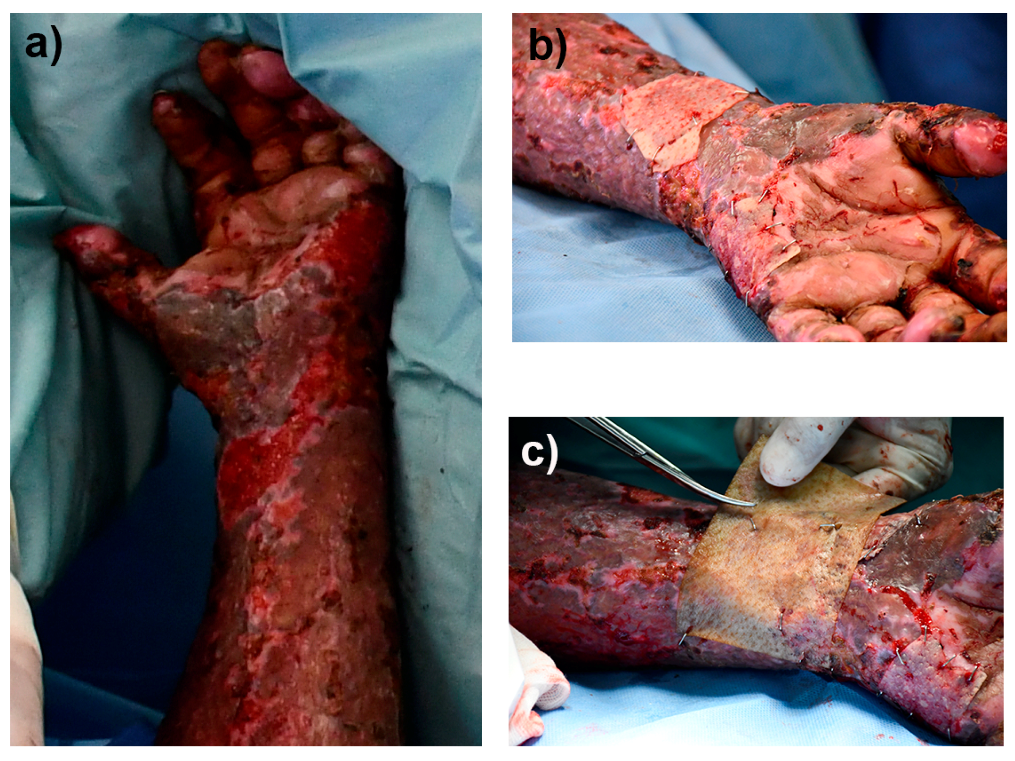 Pharmaceutics 15 02105 g008