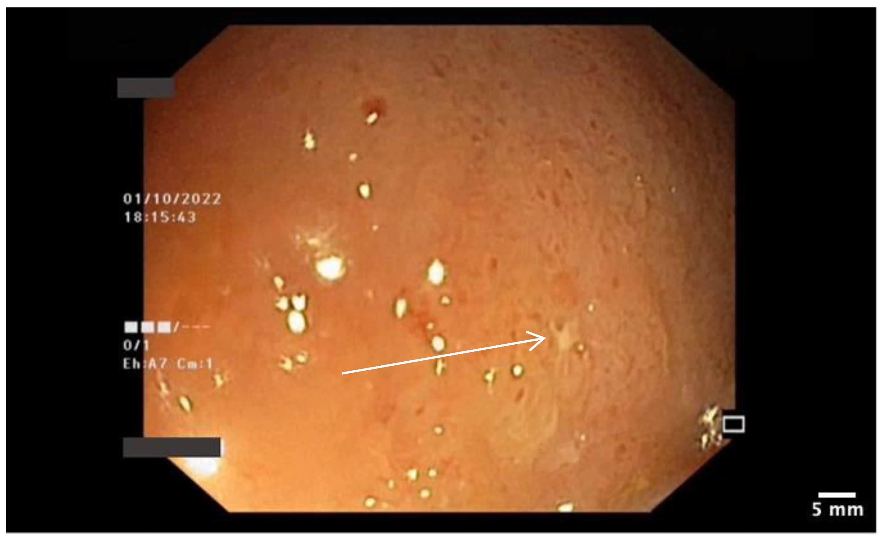 Pharmaceutics 15 02171 g005