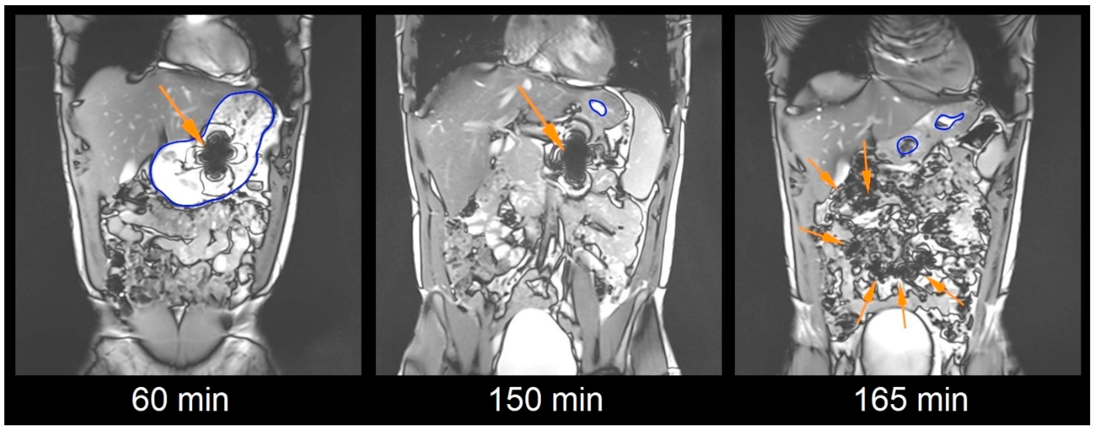 Pharmaceutics 15 02576 g001