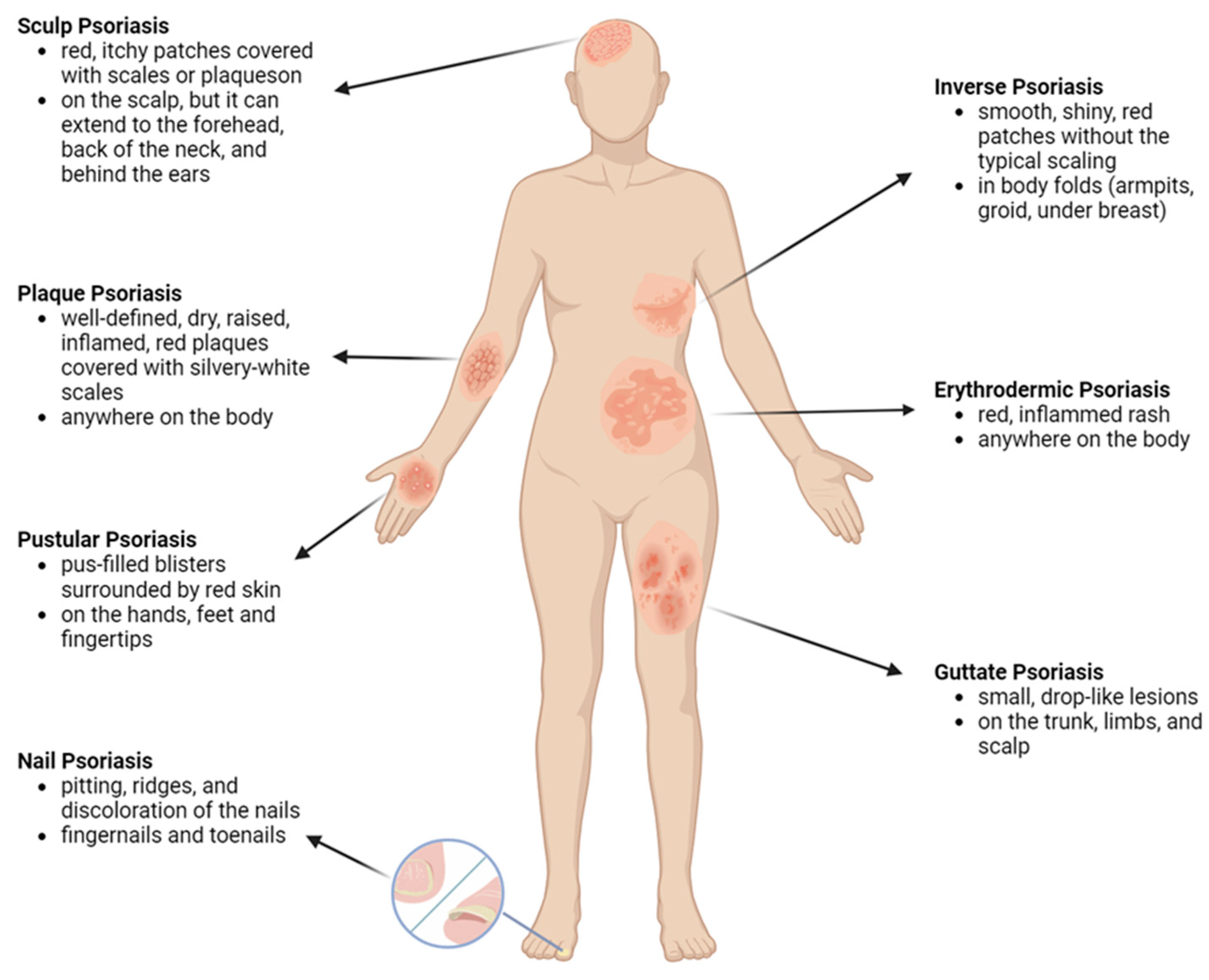 Pharmaceutics 16 00449 g002 Pharmaceutics 16 00449 g002