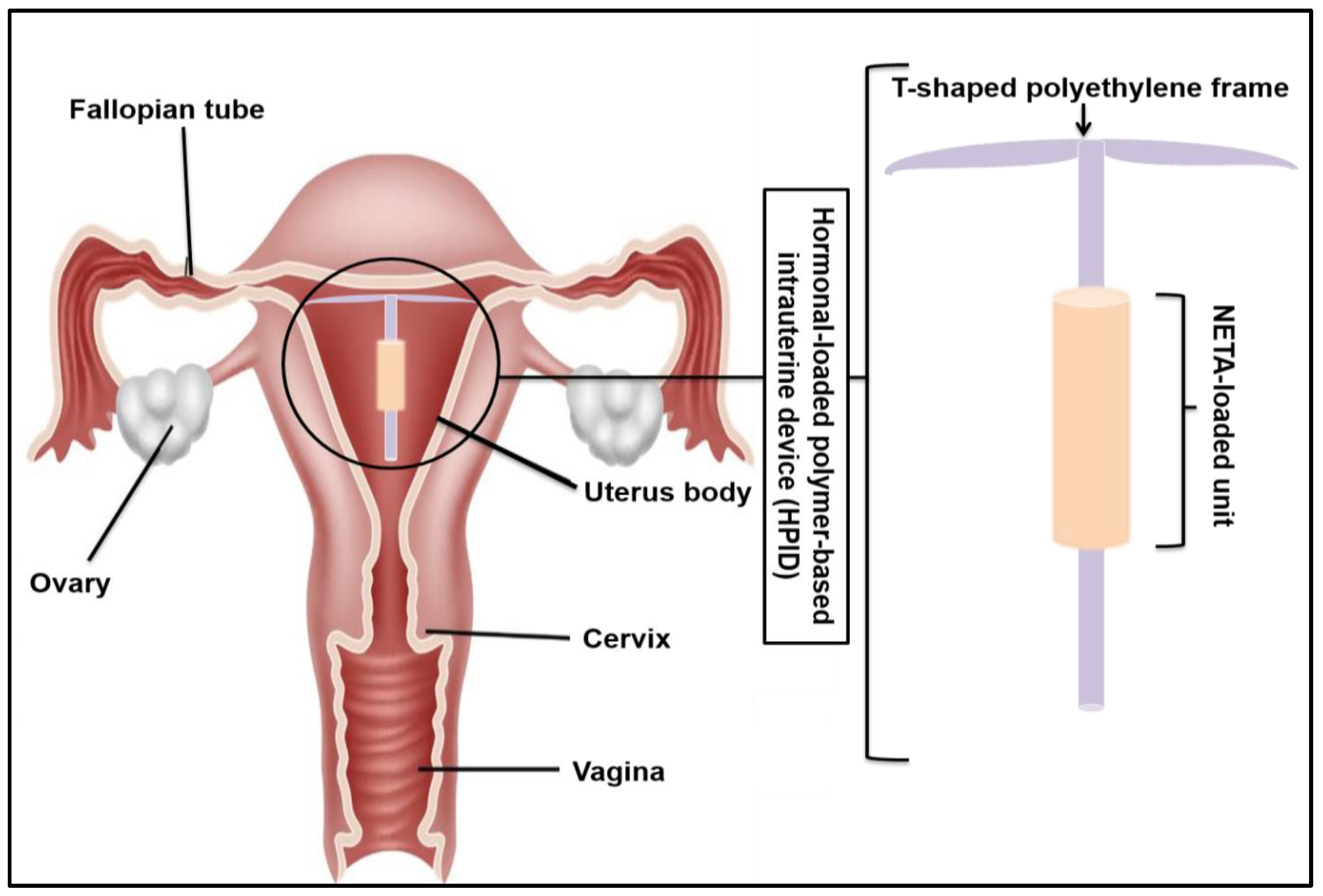Pharmaceutics 16 00587 g001