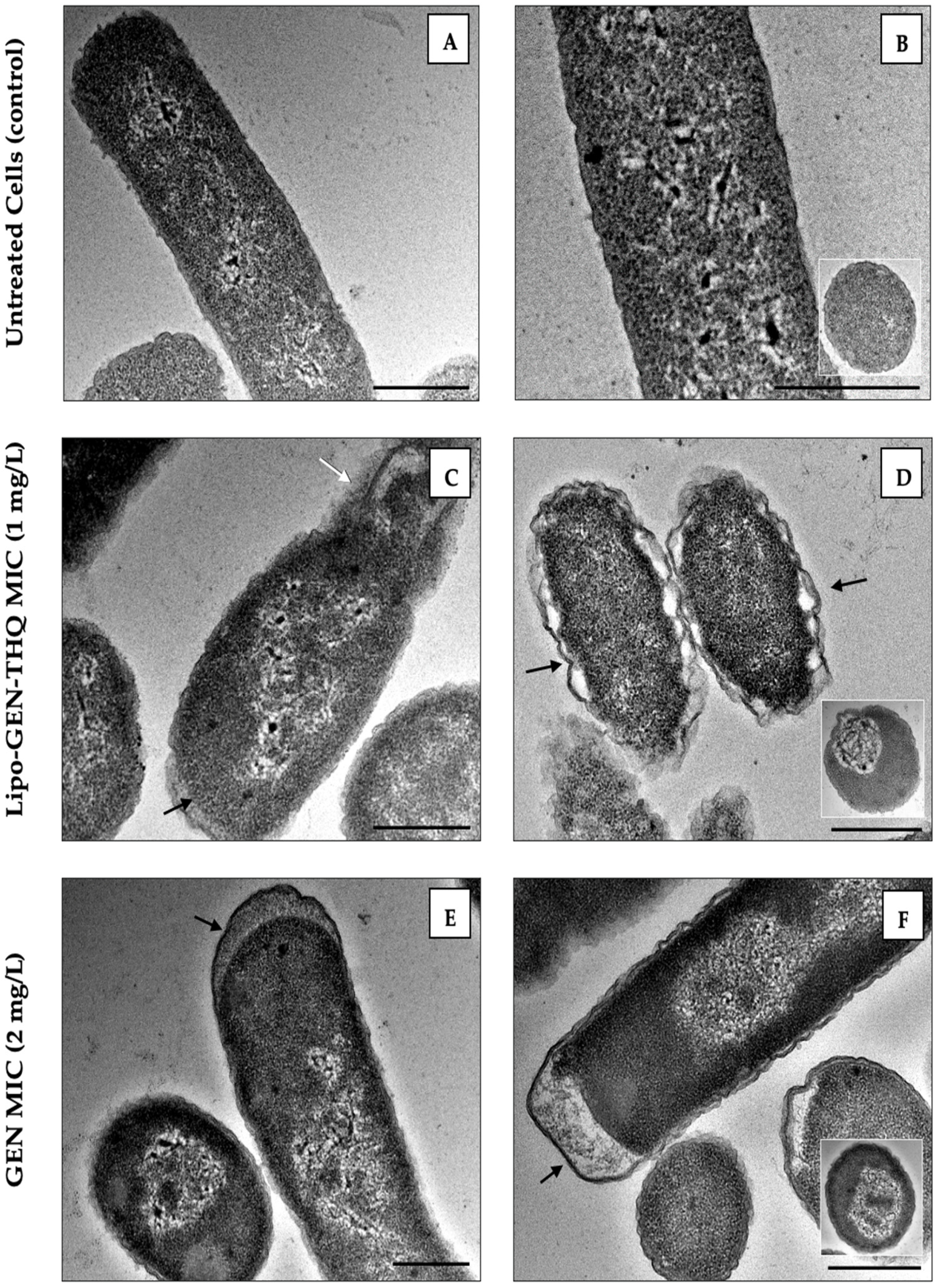 Pharmaceutics 16 01330 g006