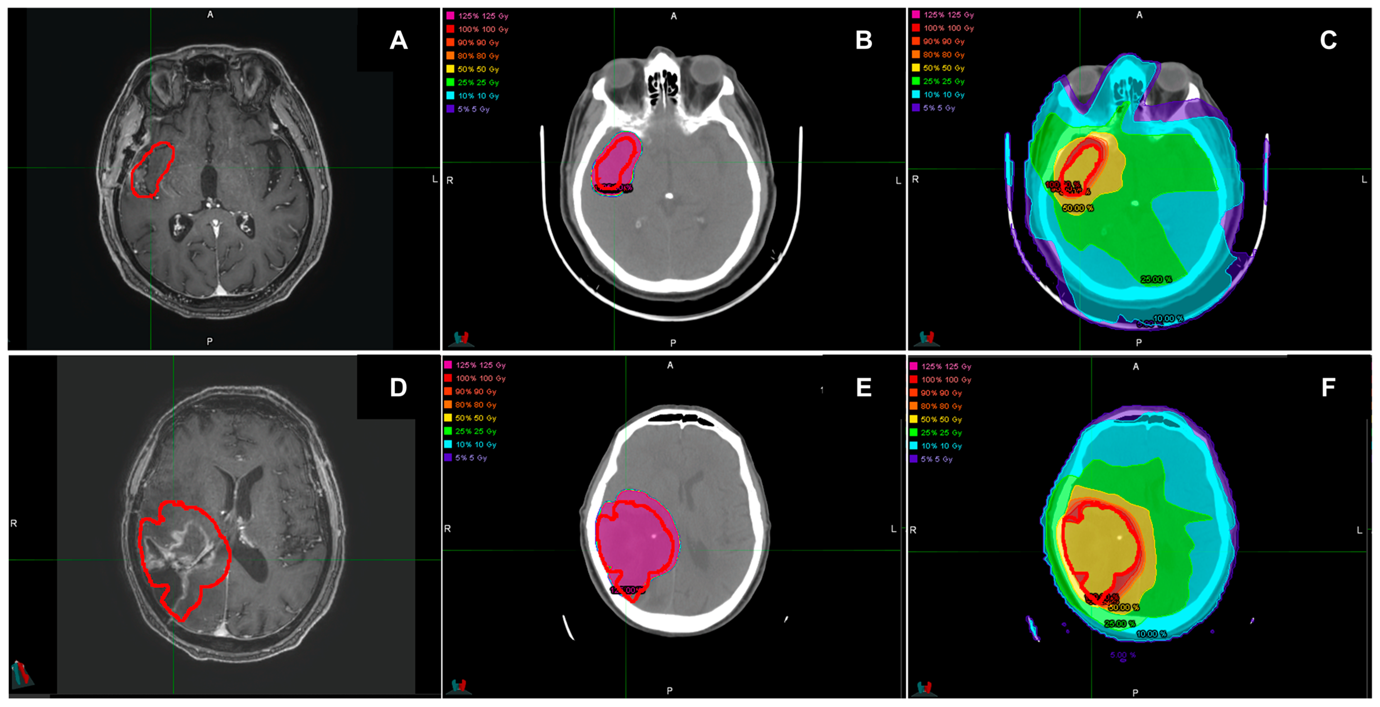 Pharmaceutics 17 00345 g003