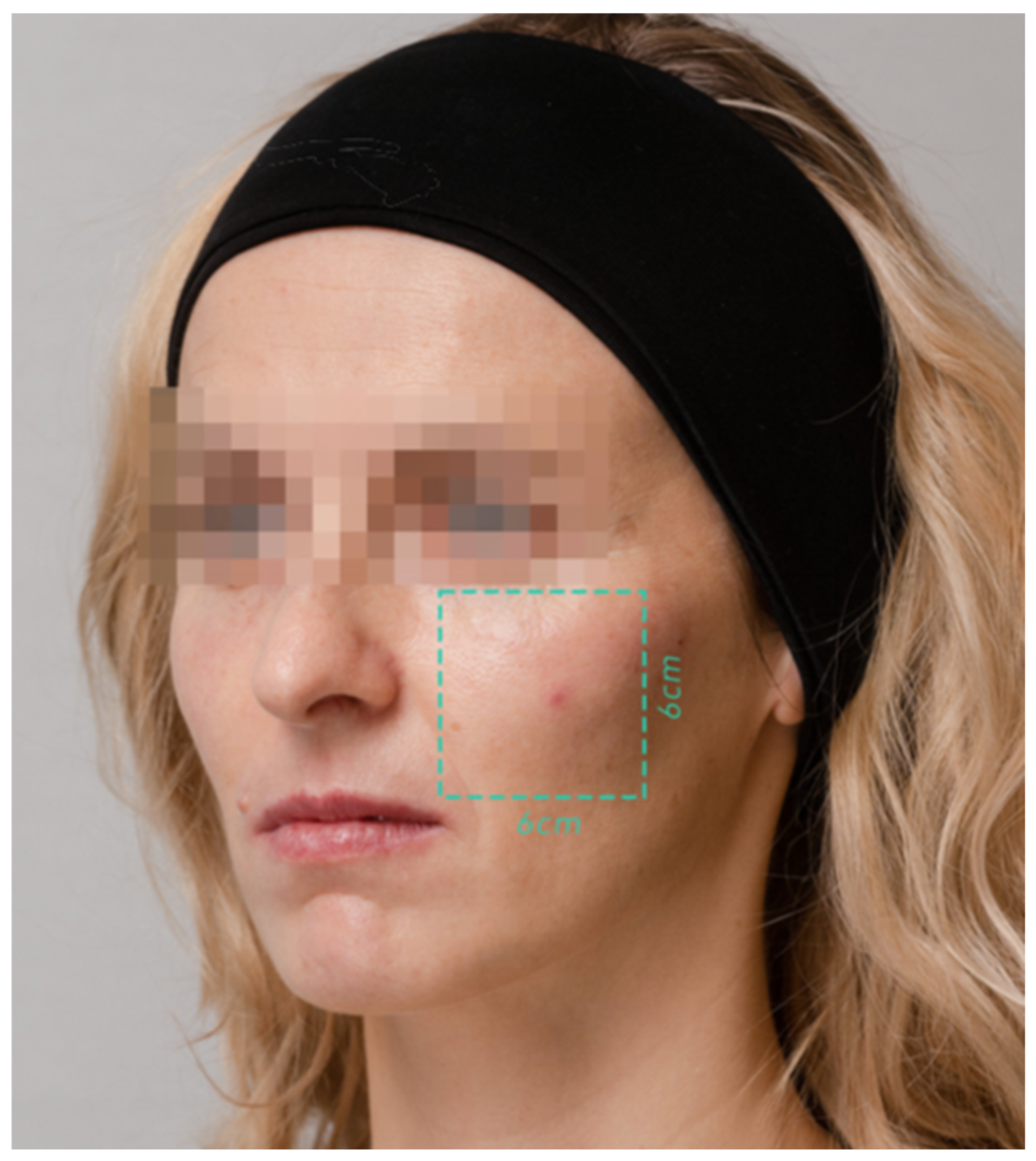 Pharmaceutics 17 00553 g001