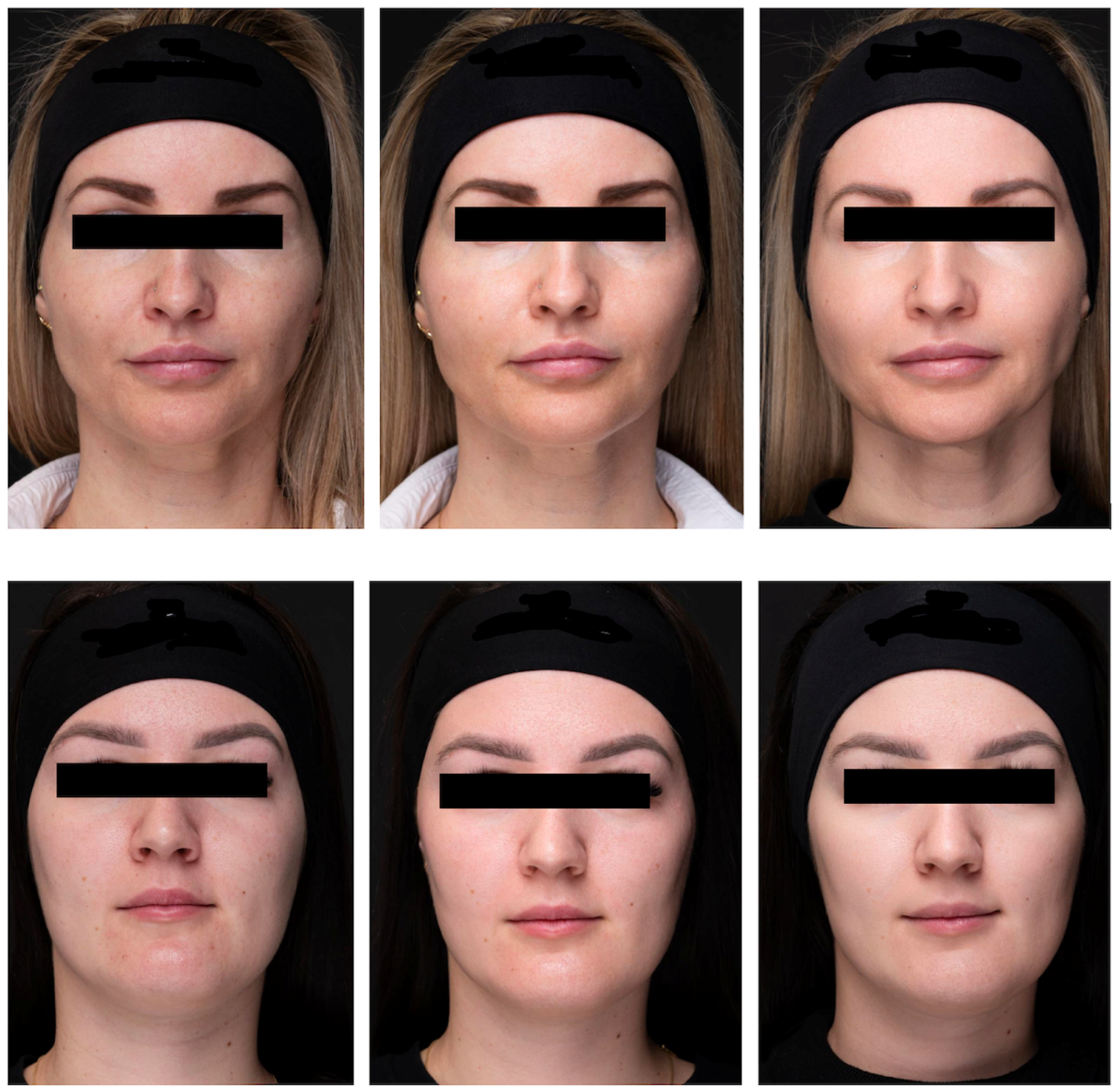 Pharmaceutics 17 00553 g007