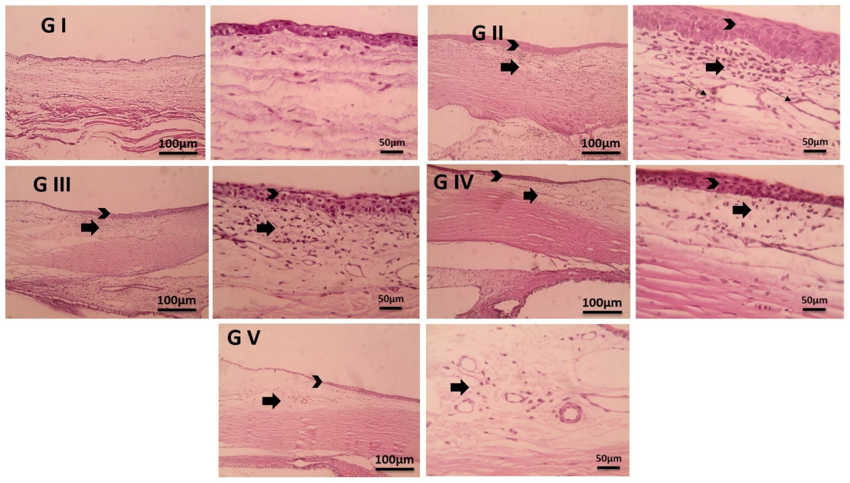 Pharmaceutics 17 00653 g011