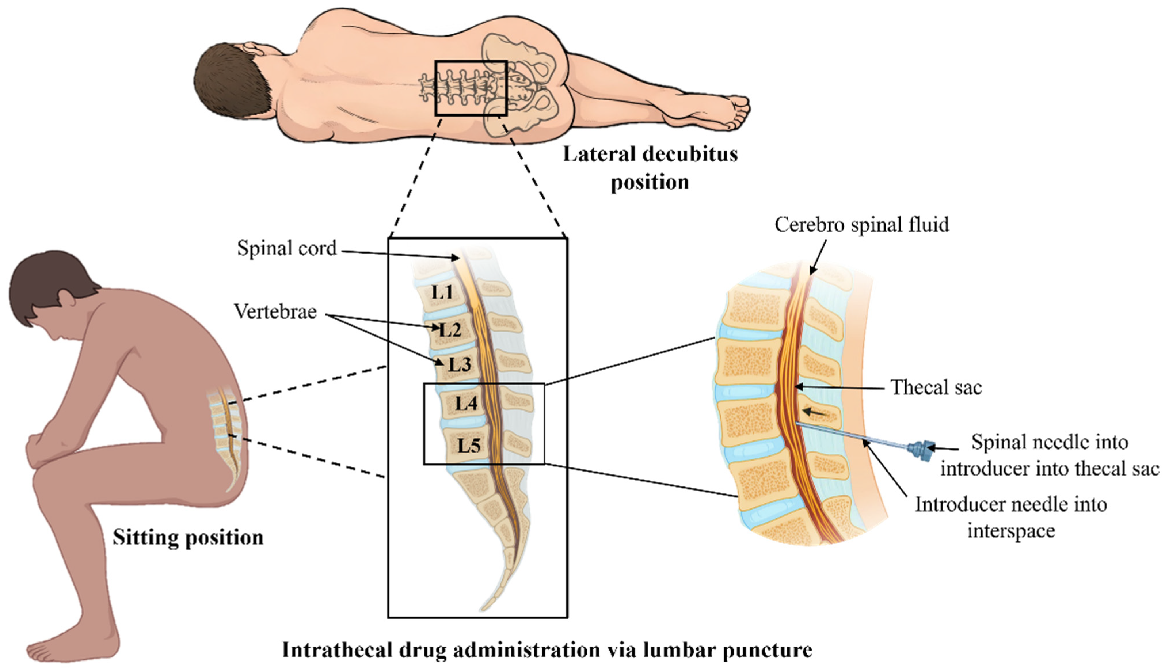 Pharmaceutics 18 00470 g004 Pharmaceutics 18 00470 g004