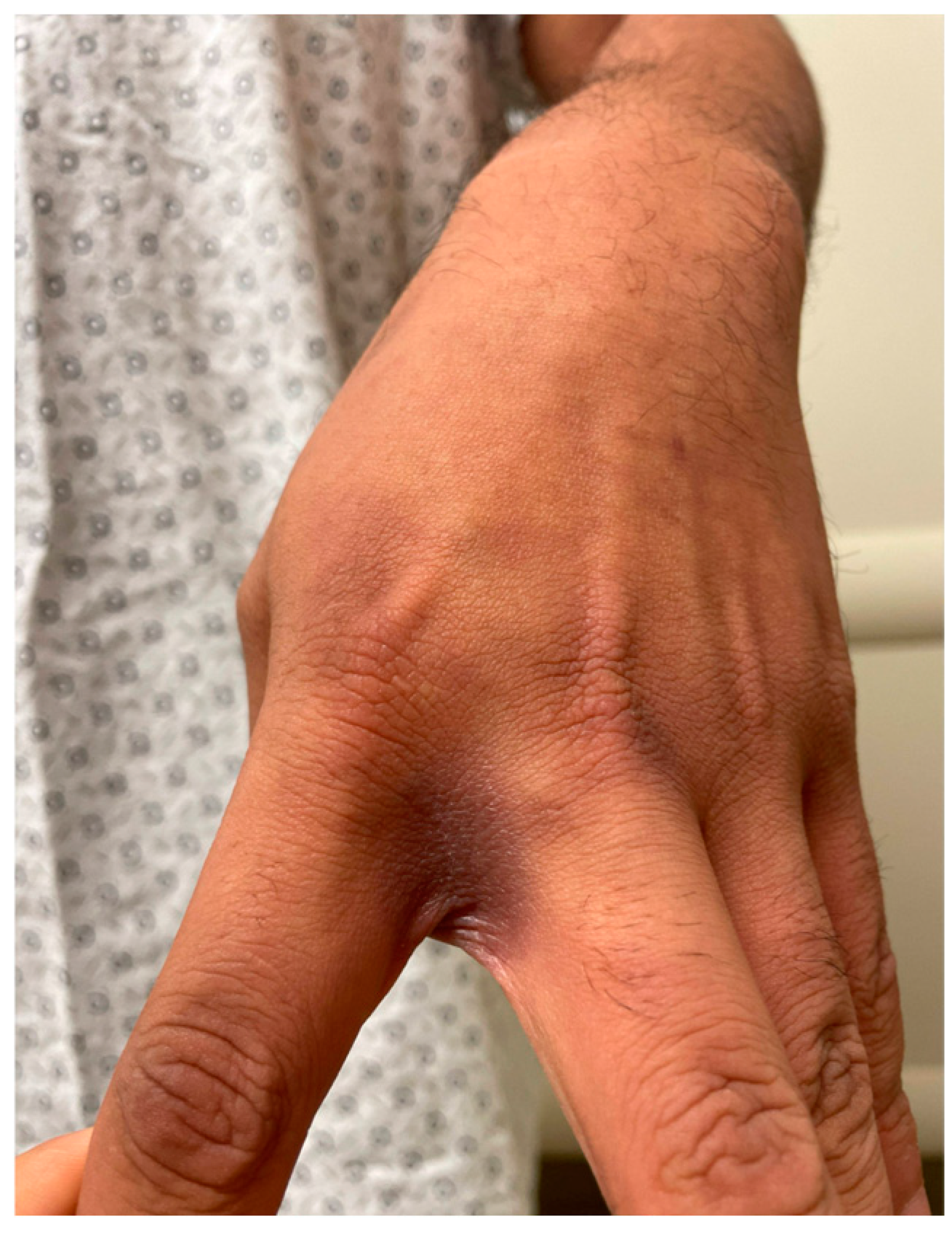 Pharmacoepidemiology 03 00028 g002