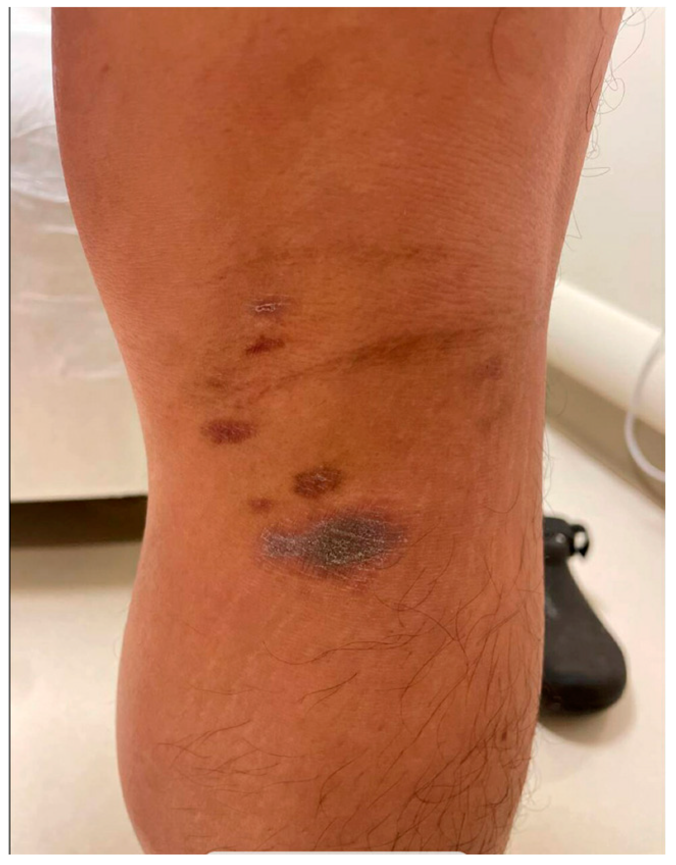 Pharmacoepidemiology 03 00028 g005