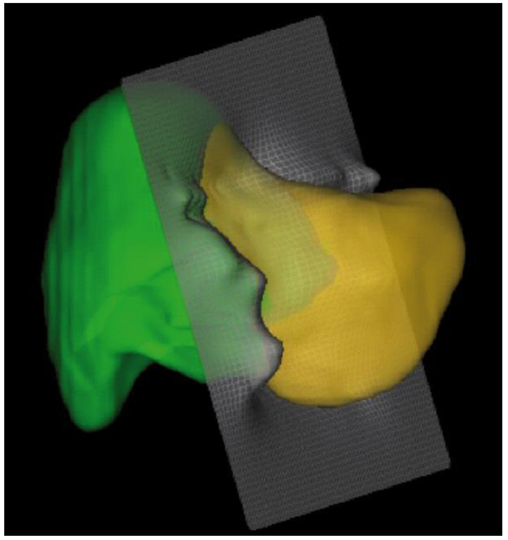 Photonics 03 00031 g006