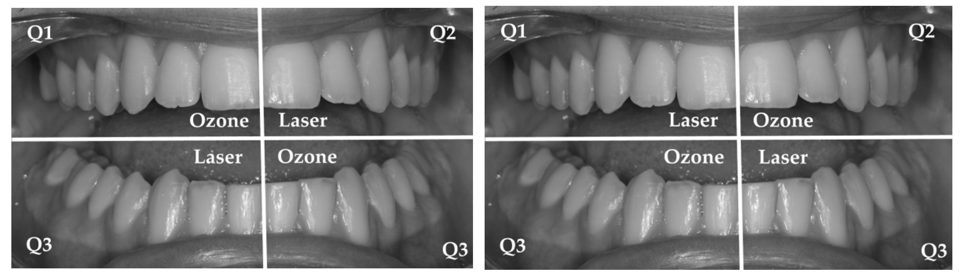 Photonics 09 00138 g001